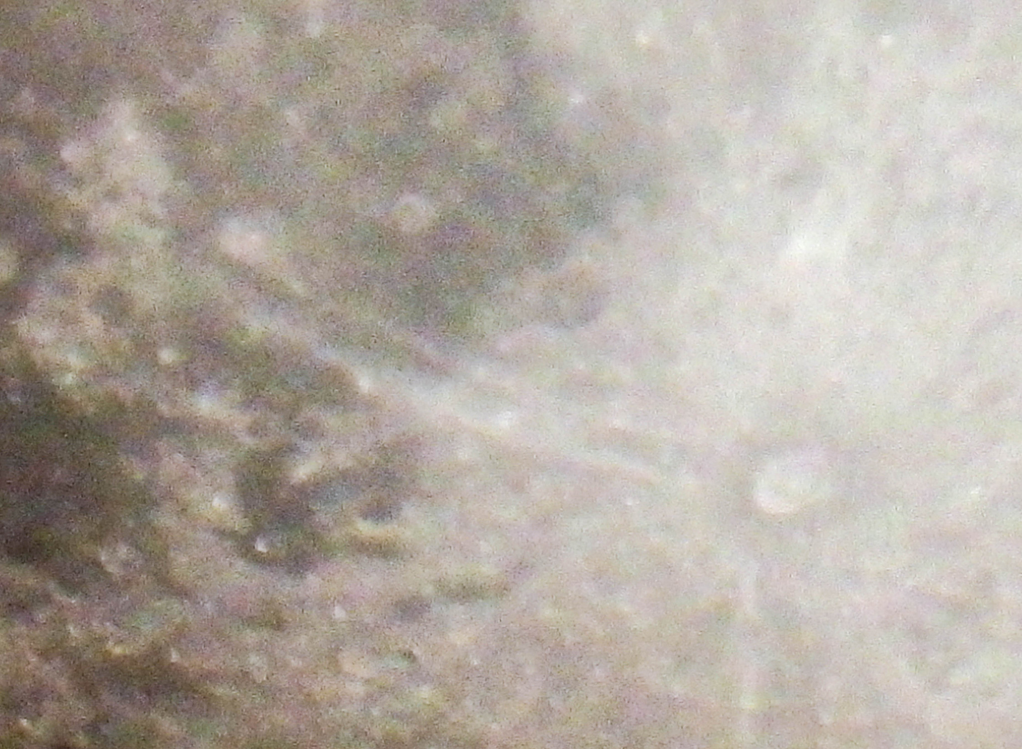 怎么判断皮肤里有没有螨虫？