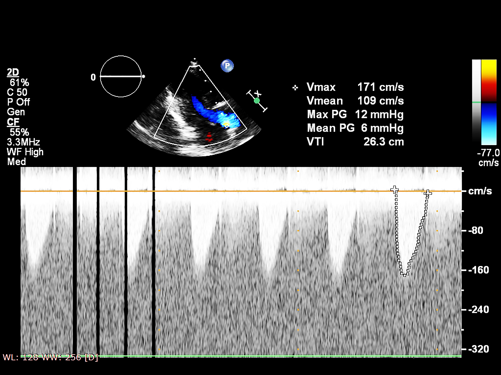 炭黑/碳纳米管/PDMS复合材料的温度变化现象及其应用潜力