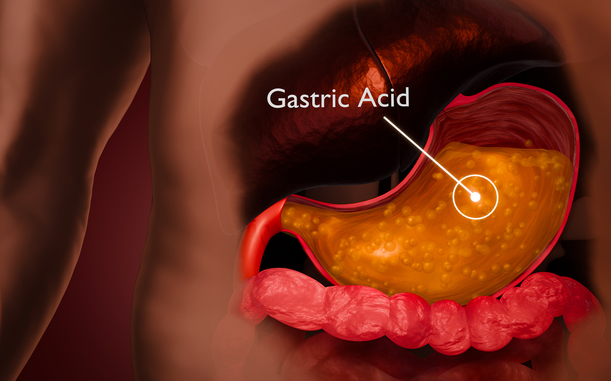 胃切除手术后果：你需要了解的风险和恢复