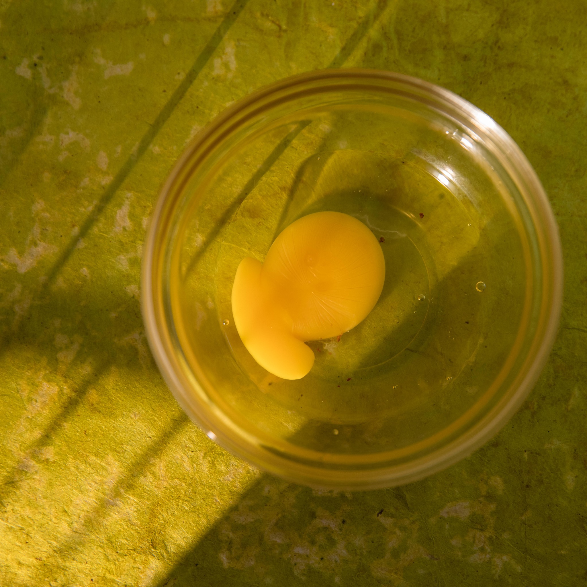 四年级学生拉肚子日记：肠腺病毒折磨，痛苦不堪！