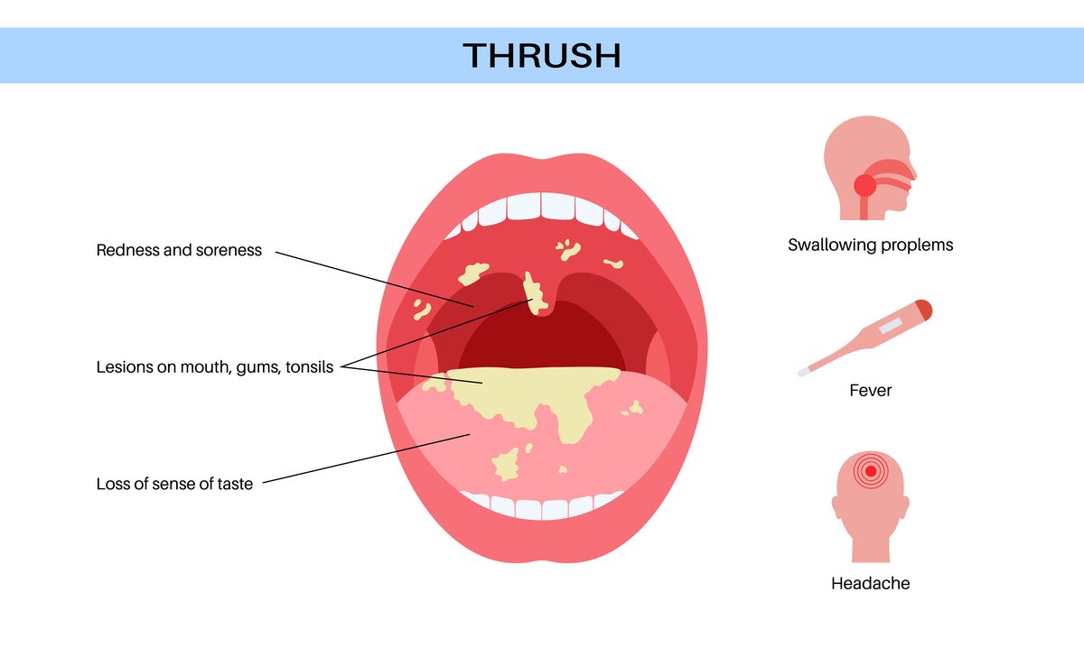 如何加强自闭症小朋友口部肌肉的灵活性