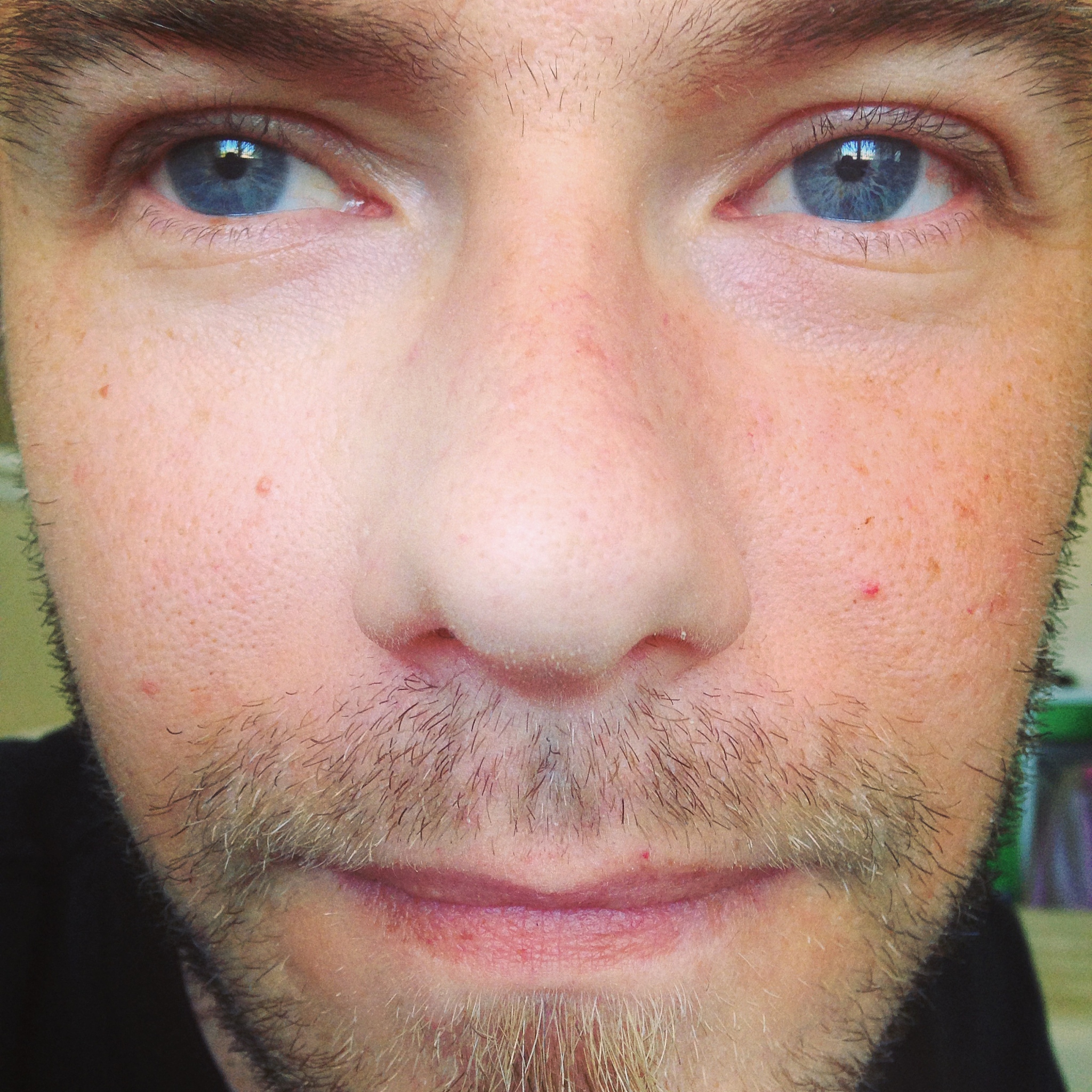 facial hair