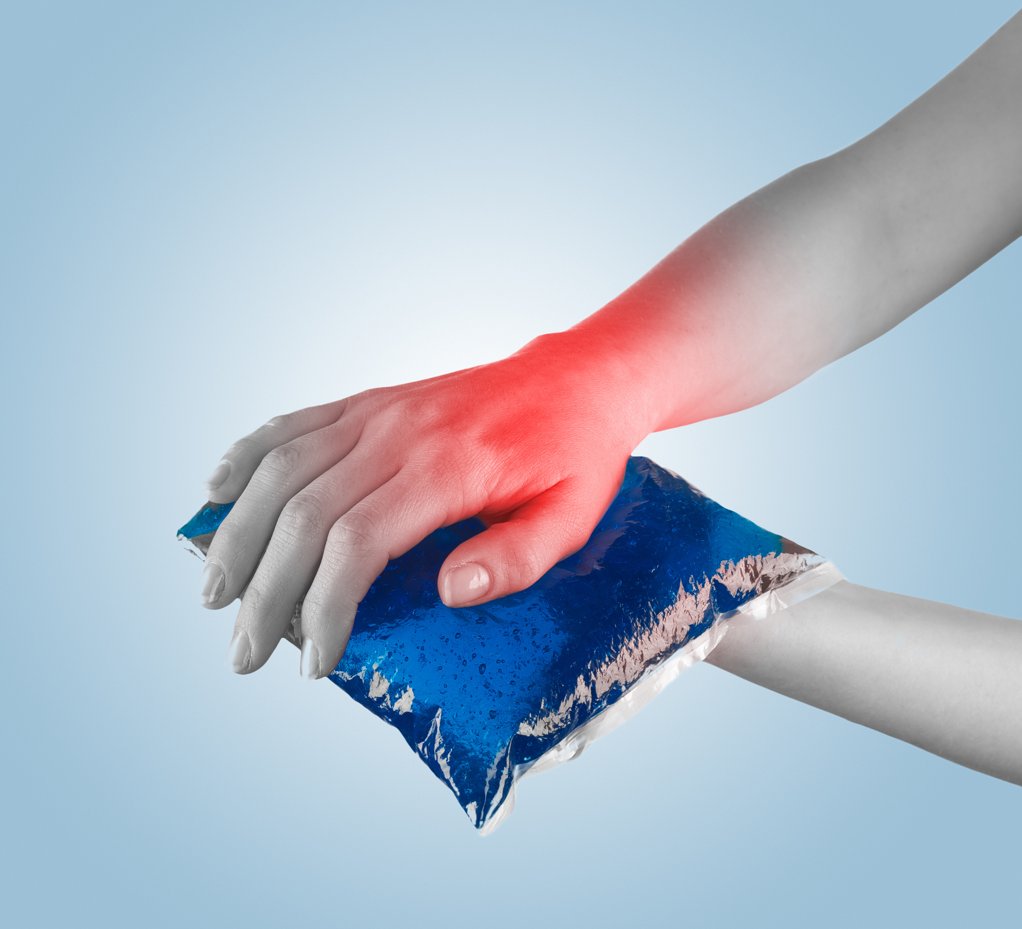 急性运动损伤处理原则：PRICE原则详解