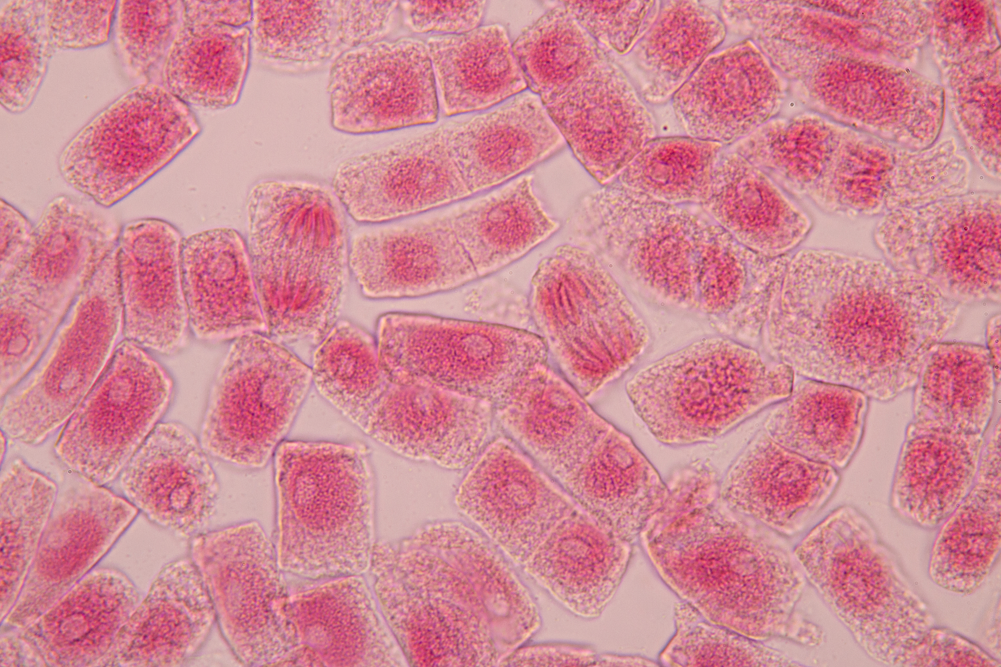 石蜡切片法：详细步骤和应用