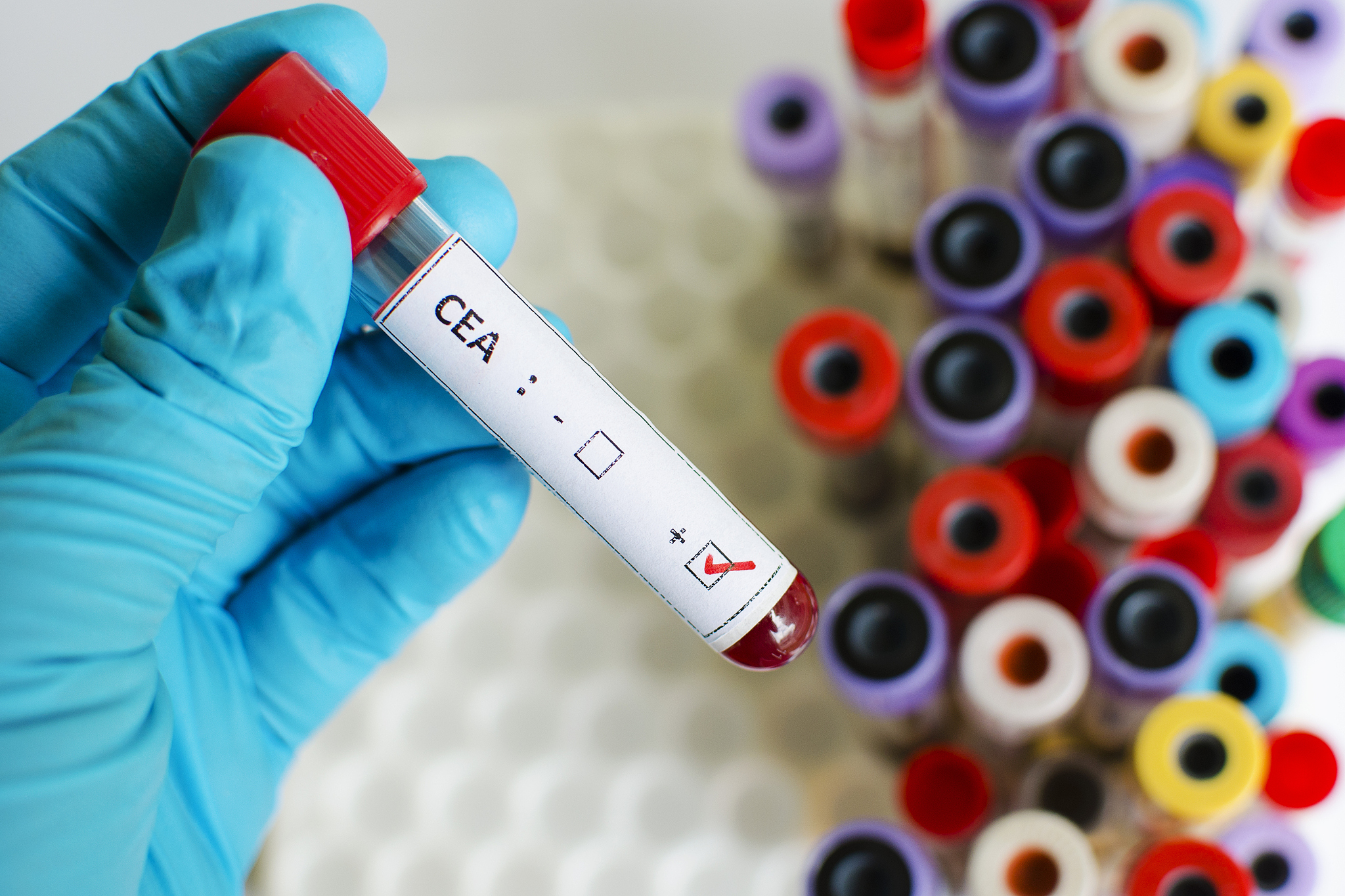 L-阿拉伯糖能被人体吸收吗？ | 了解其功效和作用