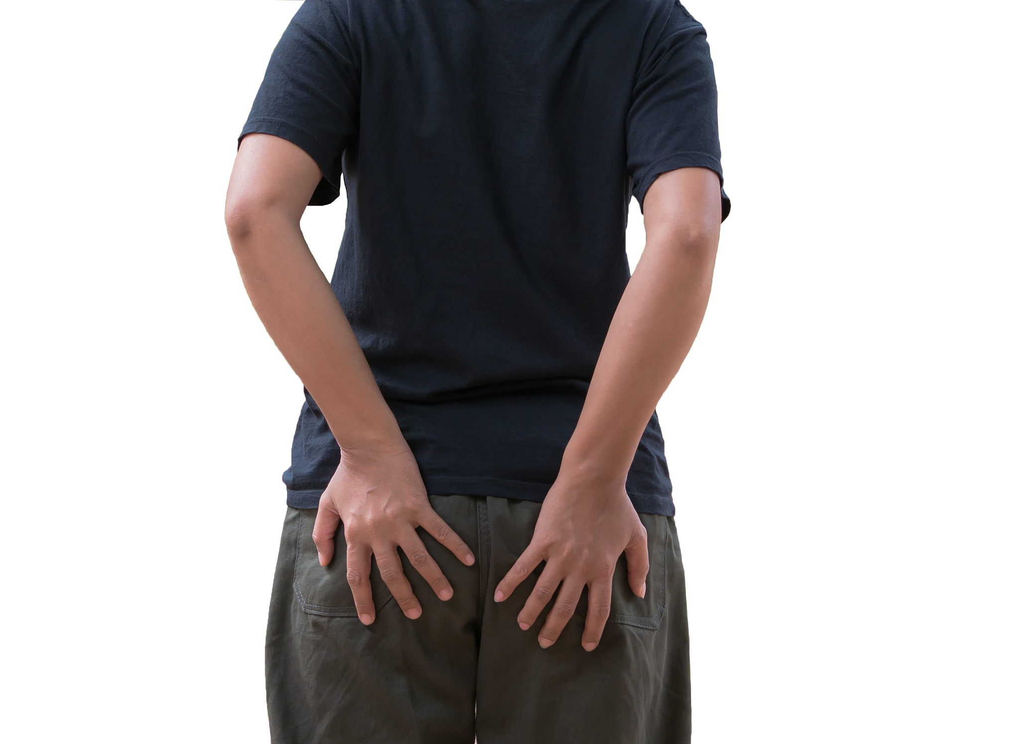 woman with hemorrhoids and constipation.