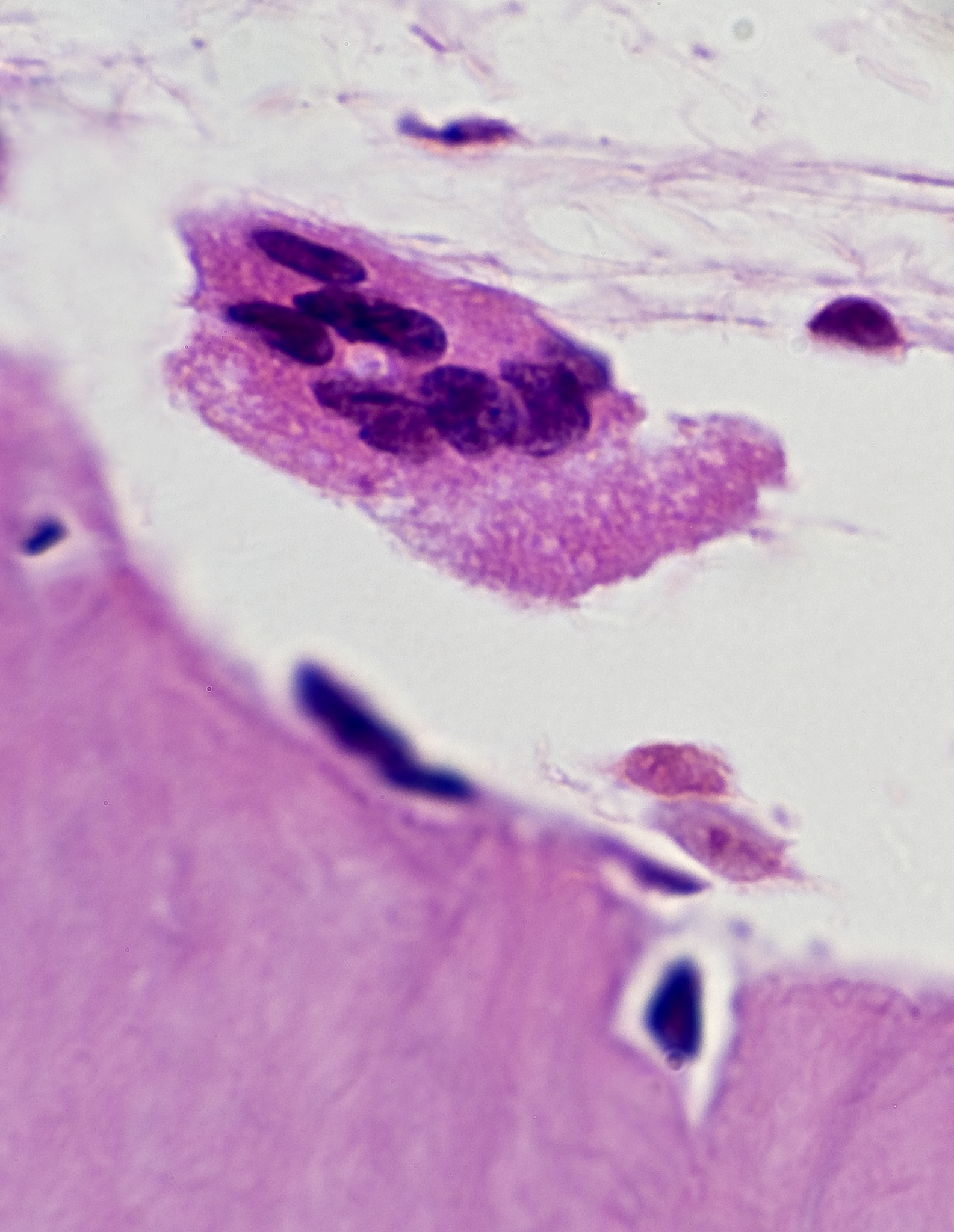 什么是骨促进？促进骨形成的因素和方法