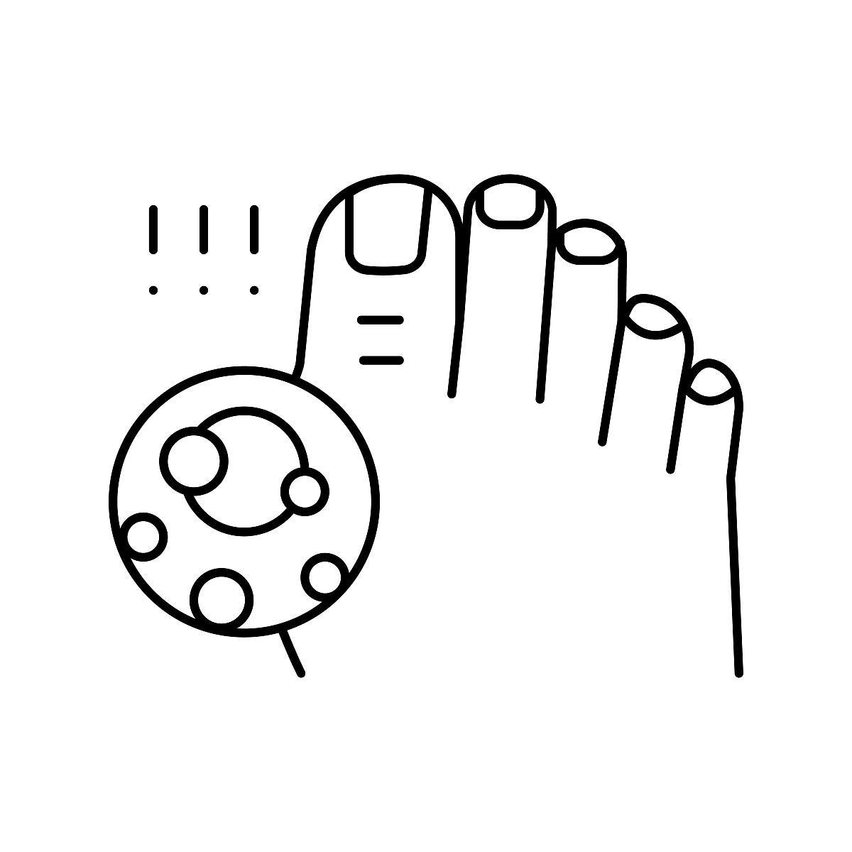 尿酸高：原因、症状、治疗及预防