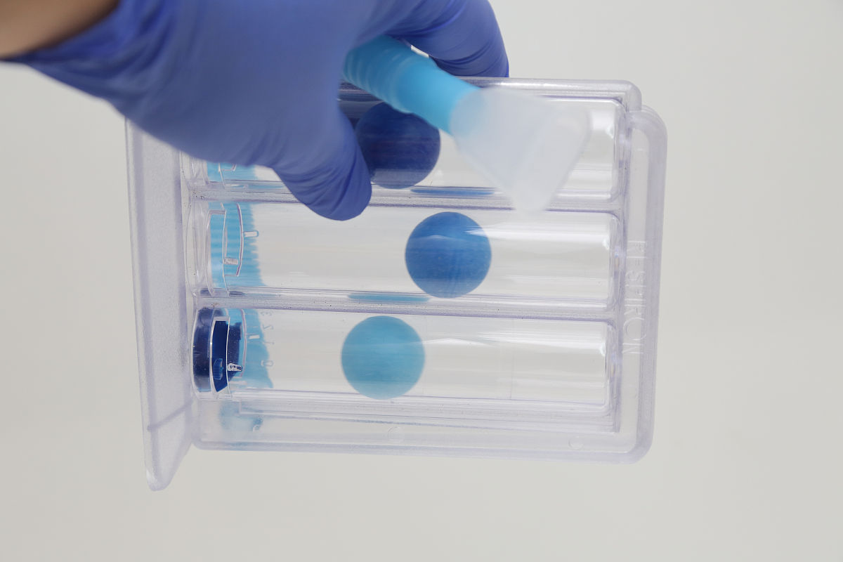 精子体外保存方法及注意事项 精子体外保存方法及注意事项