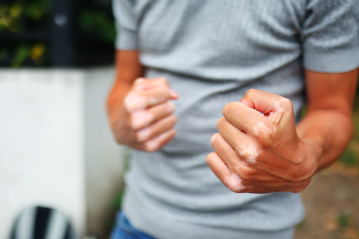 左手无力怎么办？- 了解左手乏力的原因和治疗方法