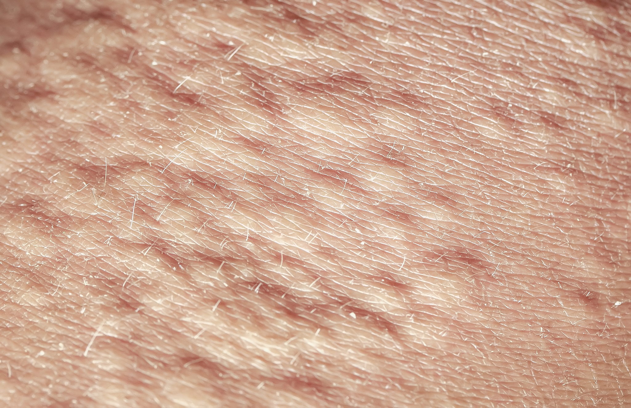 background of the texture rogennoe human skin is covered with fi