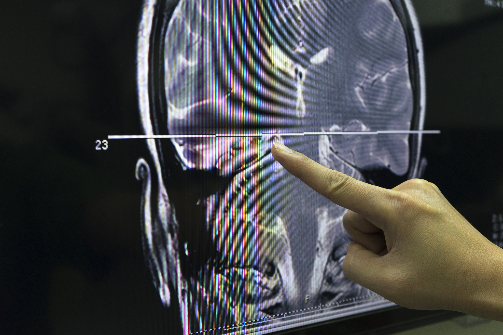 医用物理学：应用、收获与感悟 - 物理学在医学领域的魅力