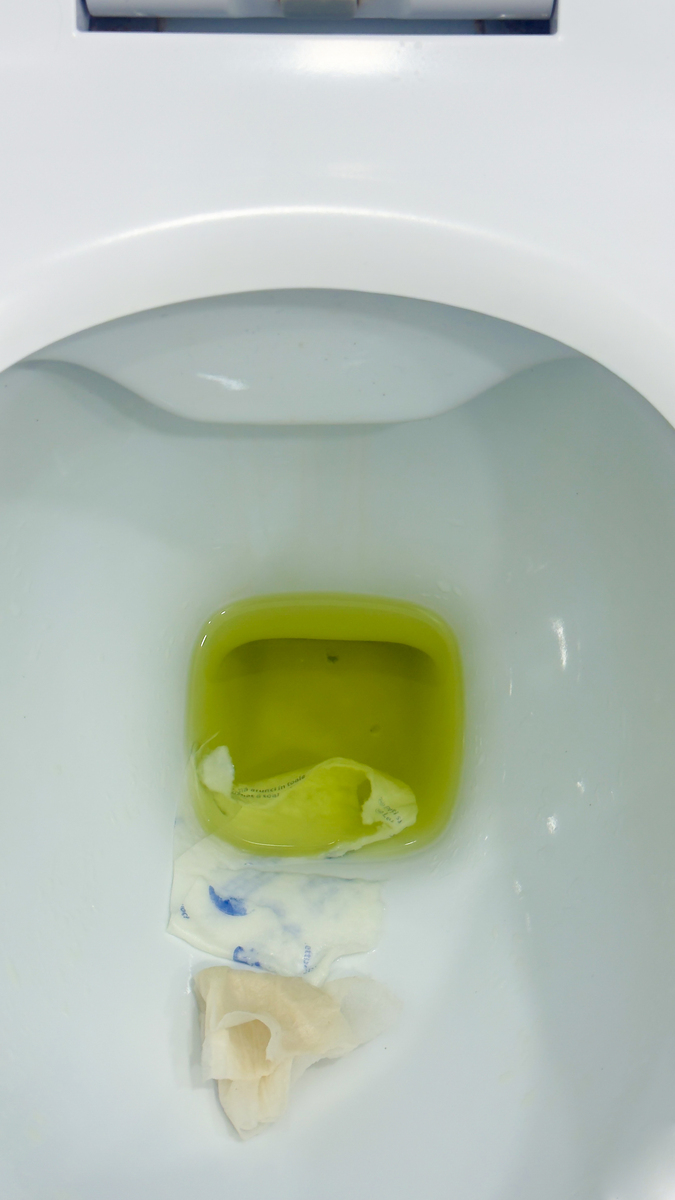 马桶堵了硬物？快速解决方法！