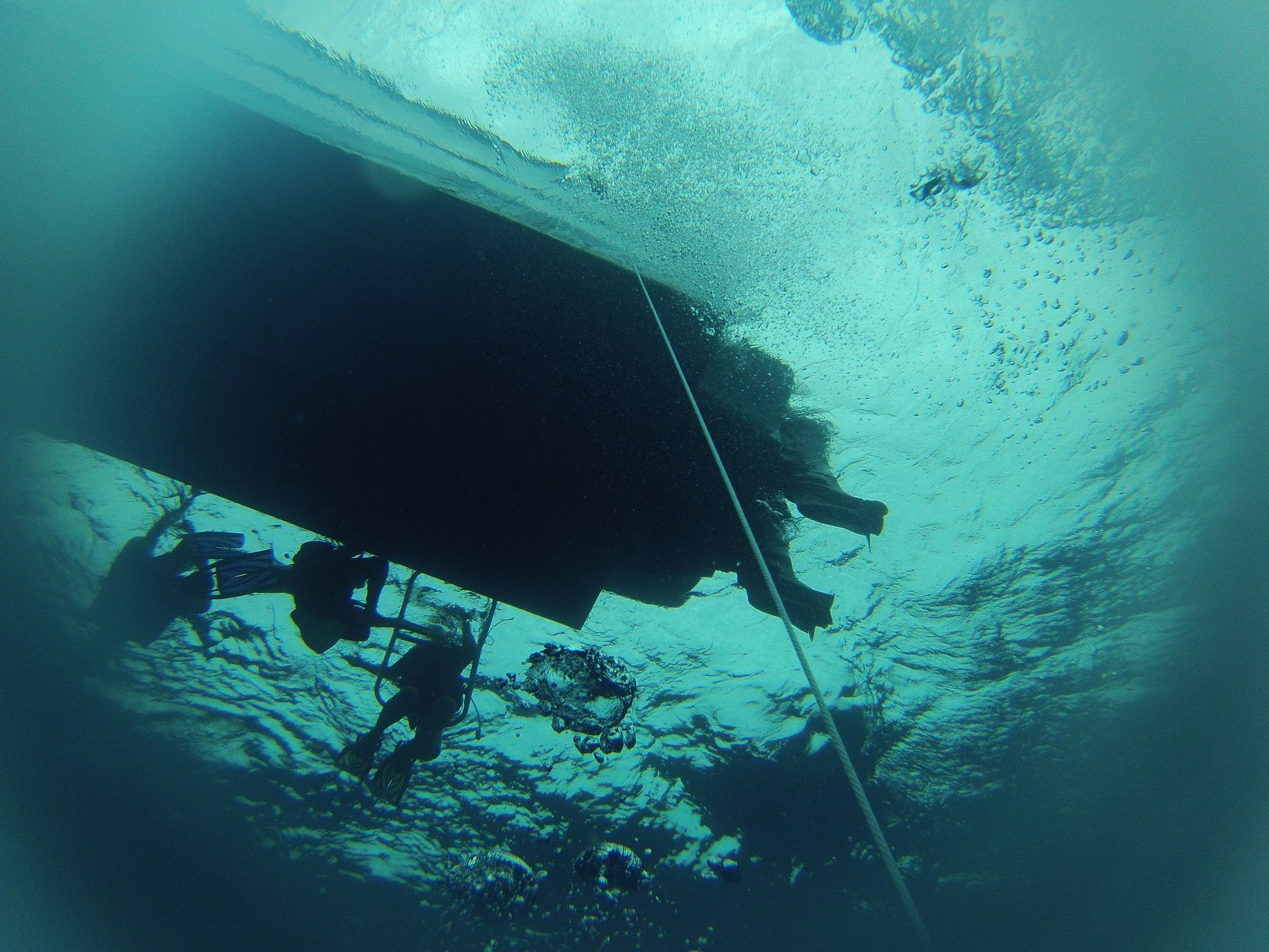 CEUS Detects Unenhanced Floating Thrombus and Plaque Vulnerability Not Seen on CTA, DSA, and Ultrasound