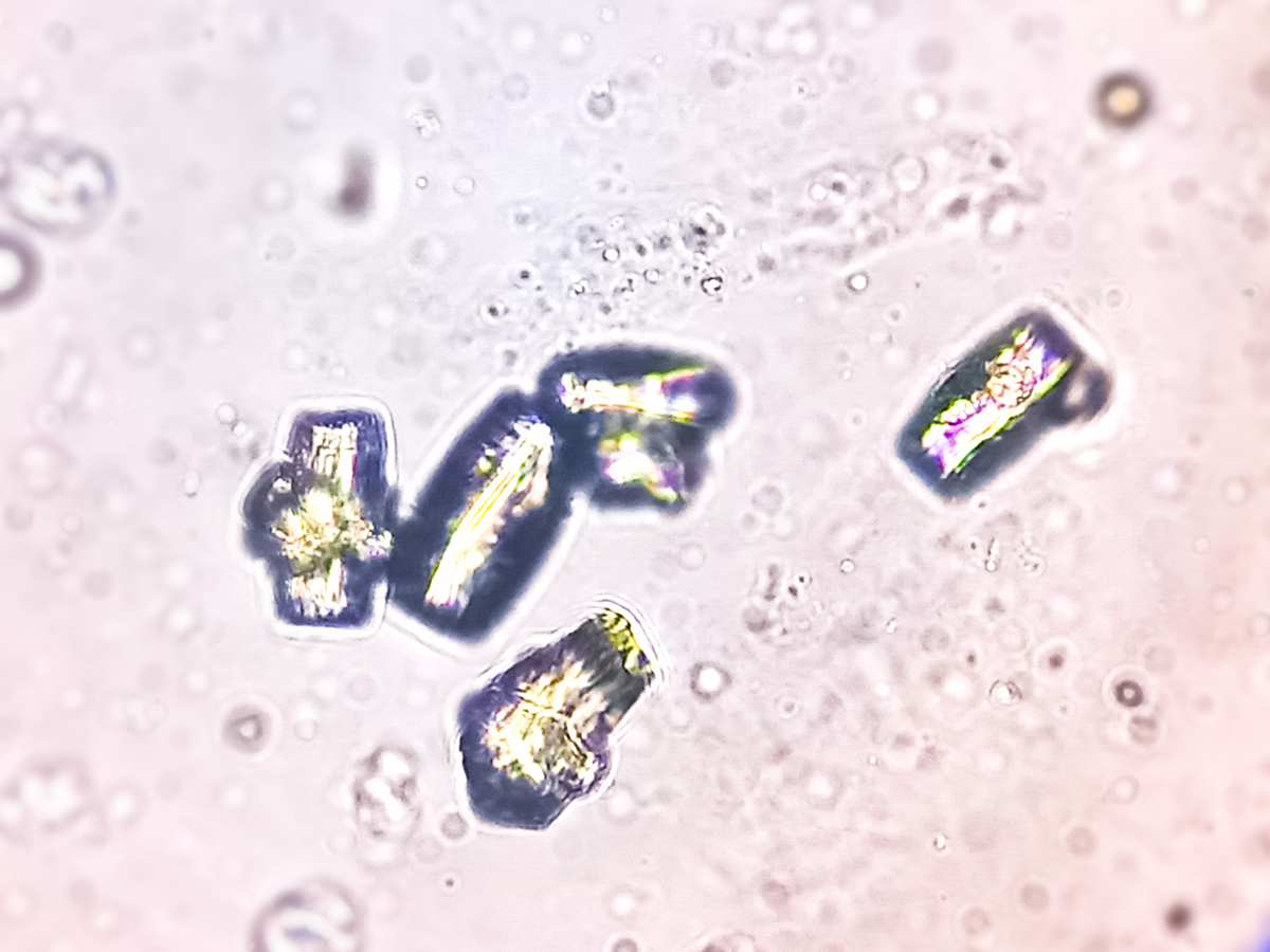 阿克曼菌：利用胃肠道黏蛋白生成短链脂肪酸