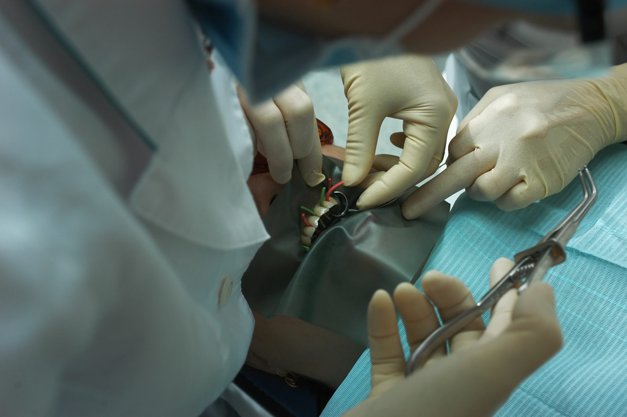 treatment of a teeth
