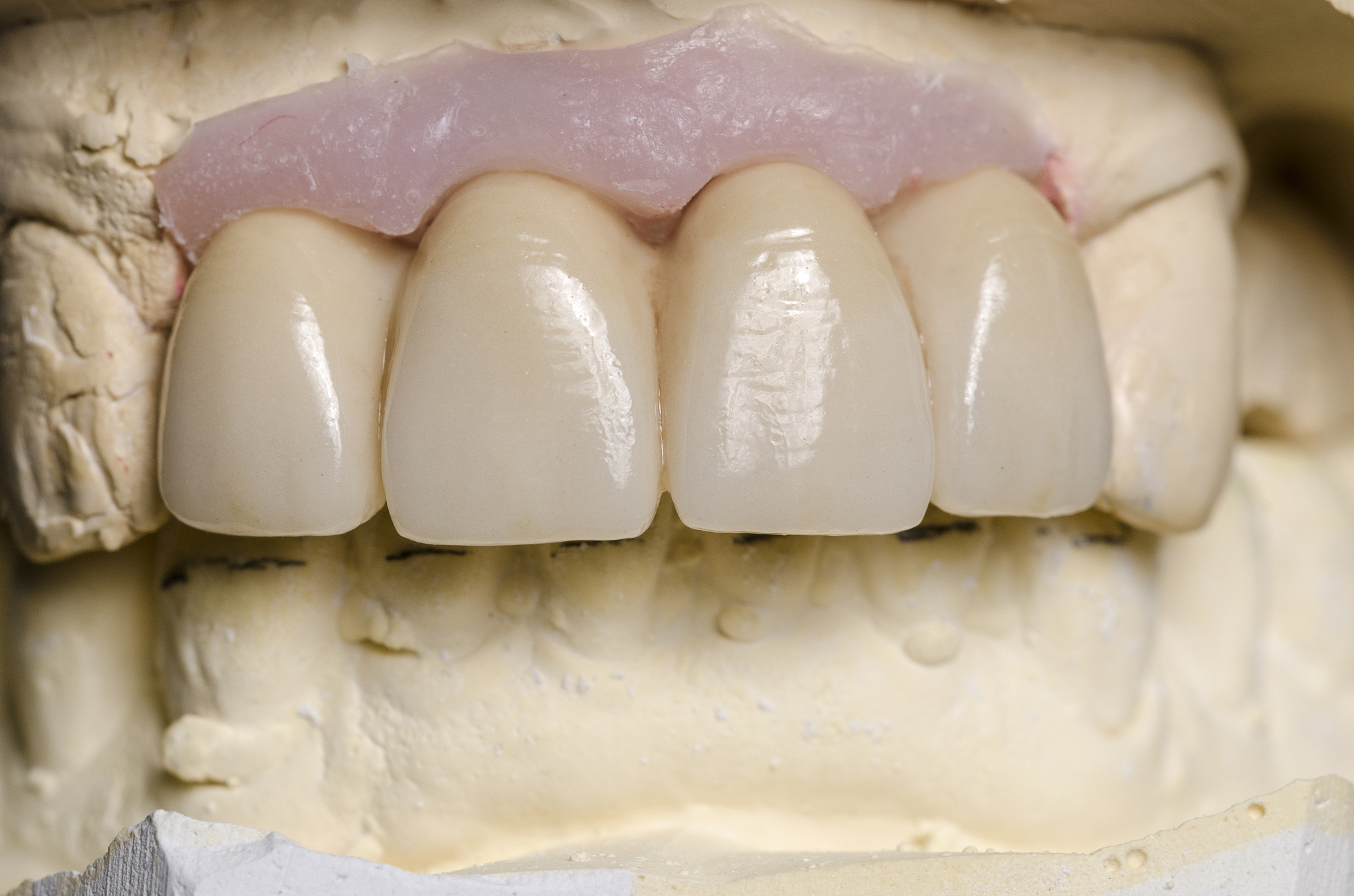 2022年江西卫生职业学院口腔医学技术专业招生