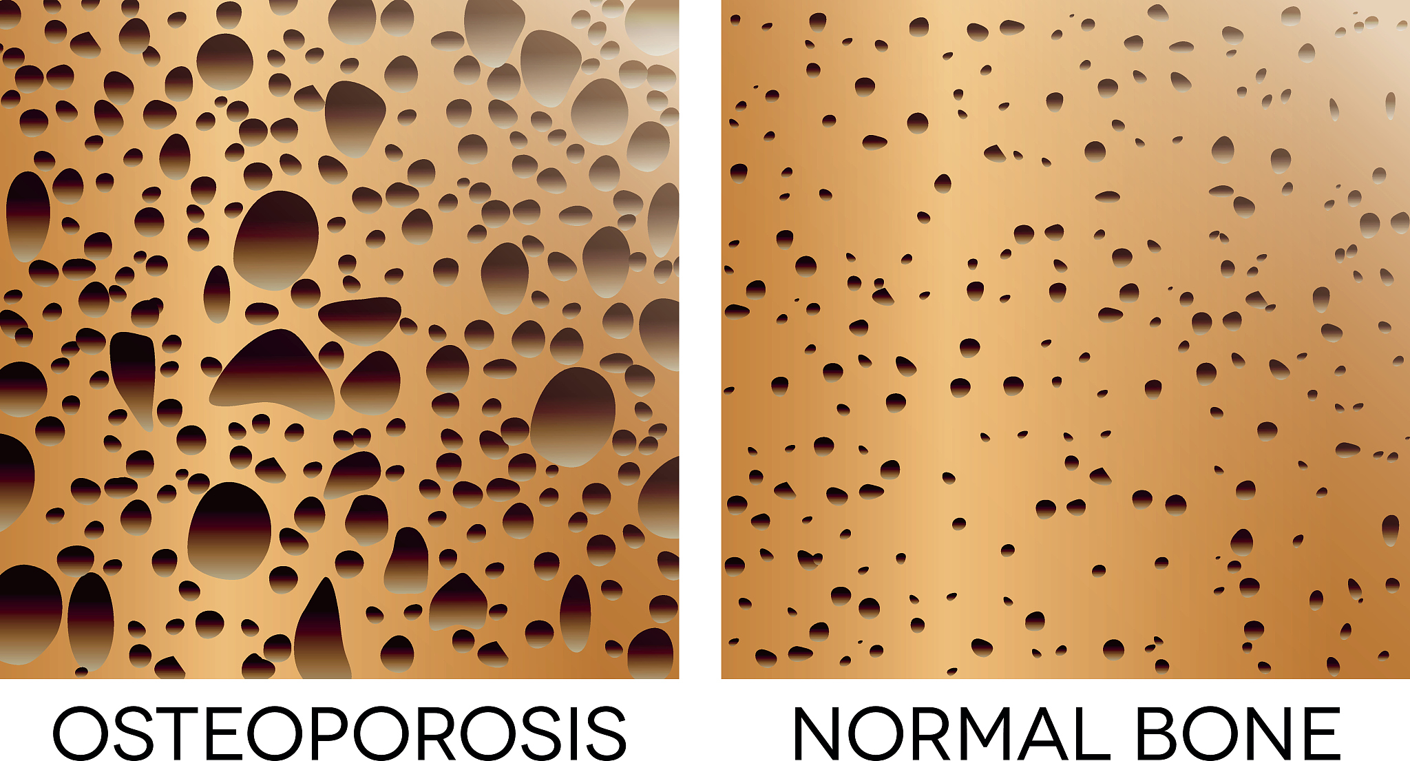 国珍牌磷脂大豆异黄酮软胶囊是否具有预防疾病的作用？