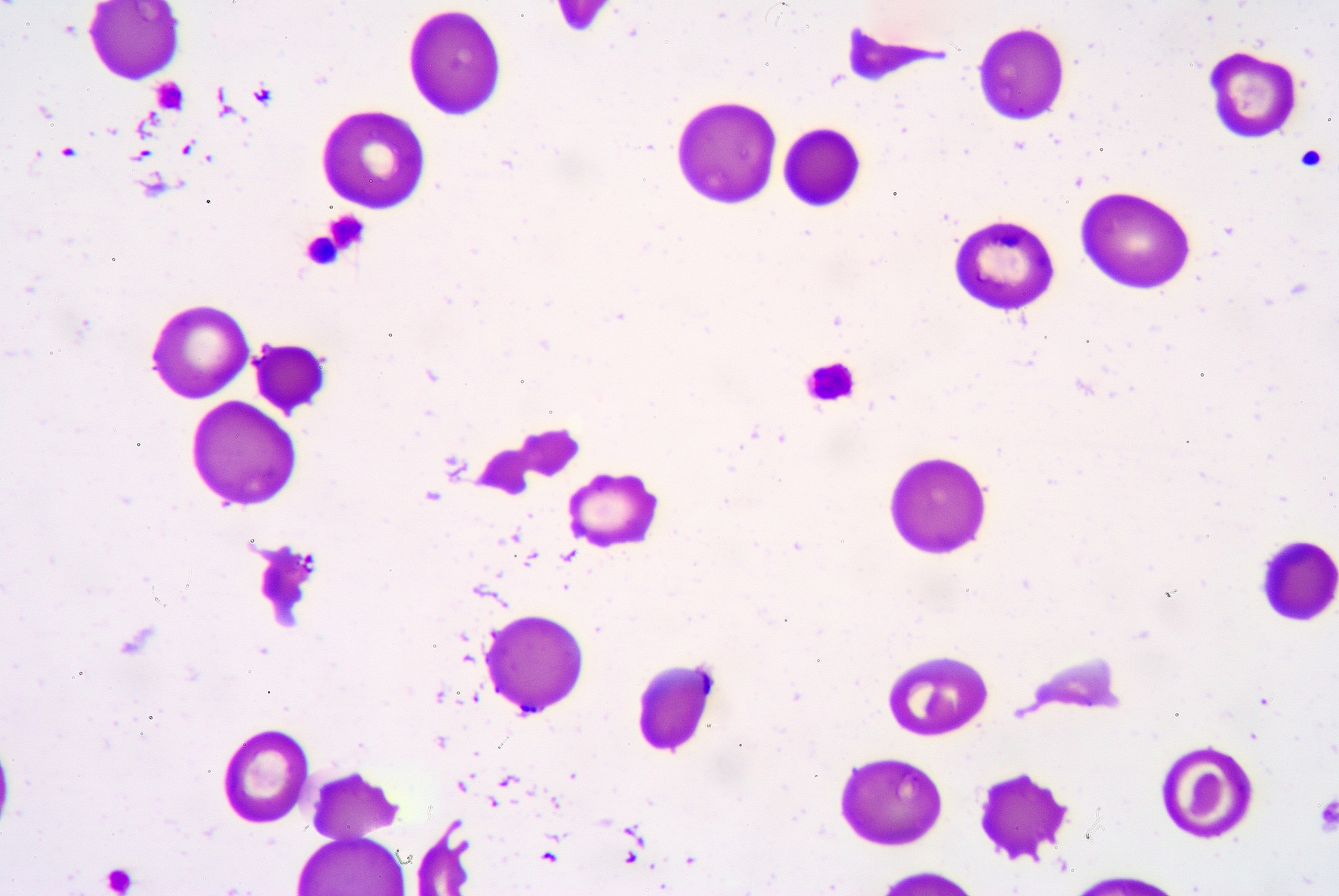 白细胞计数实验和血红蛋白含量测定实验讨论