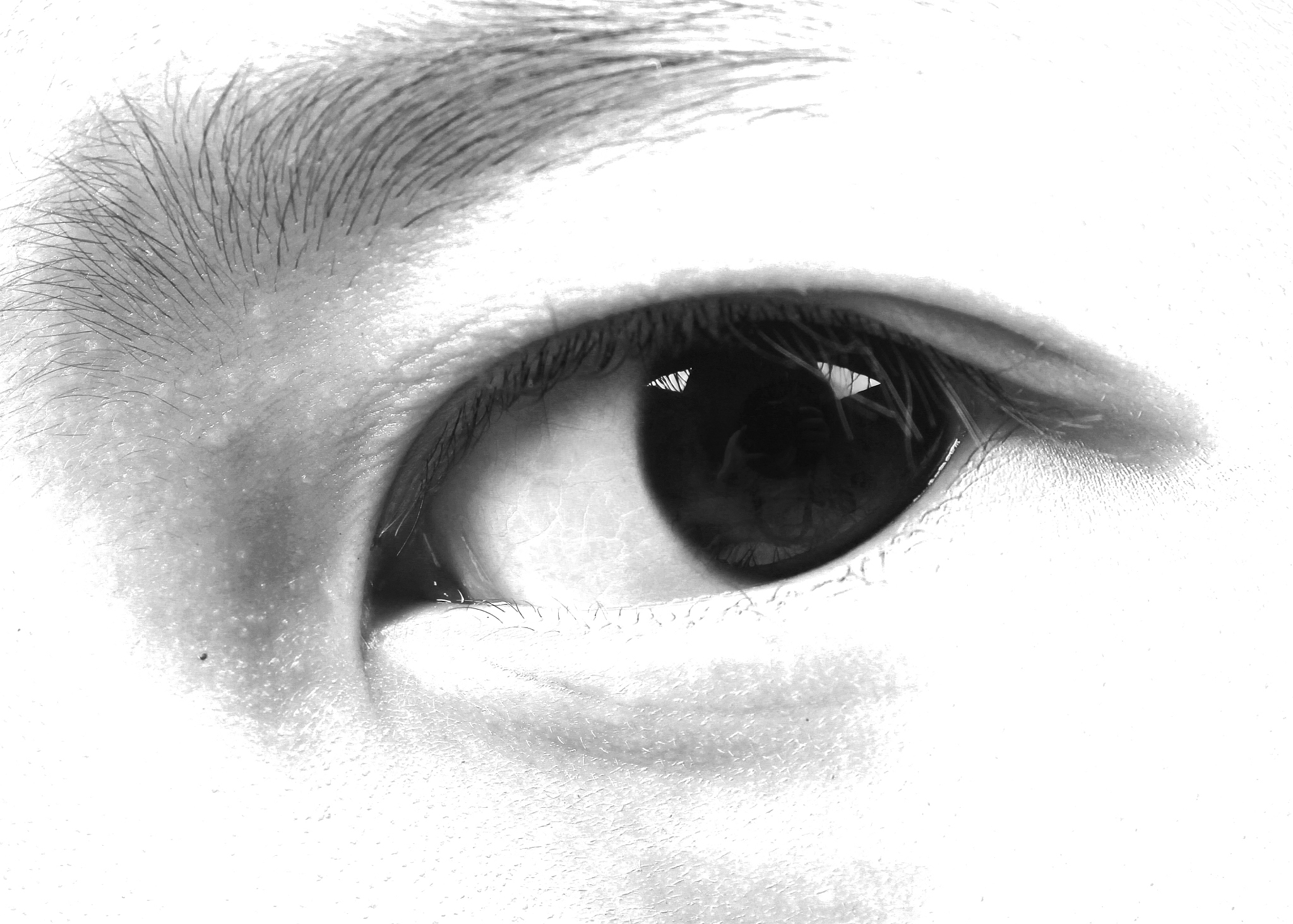 eye