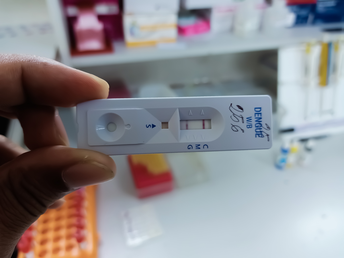 HIV 自测：居家检测，快速了解结果