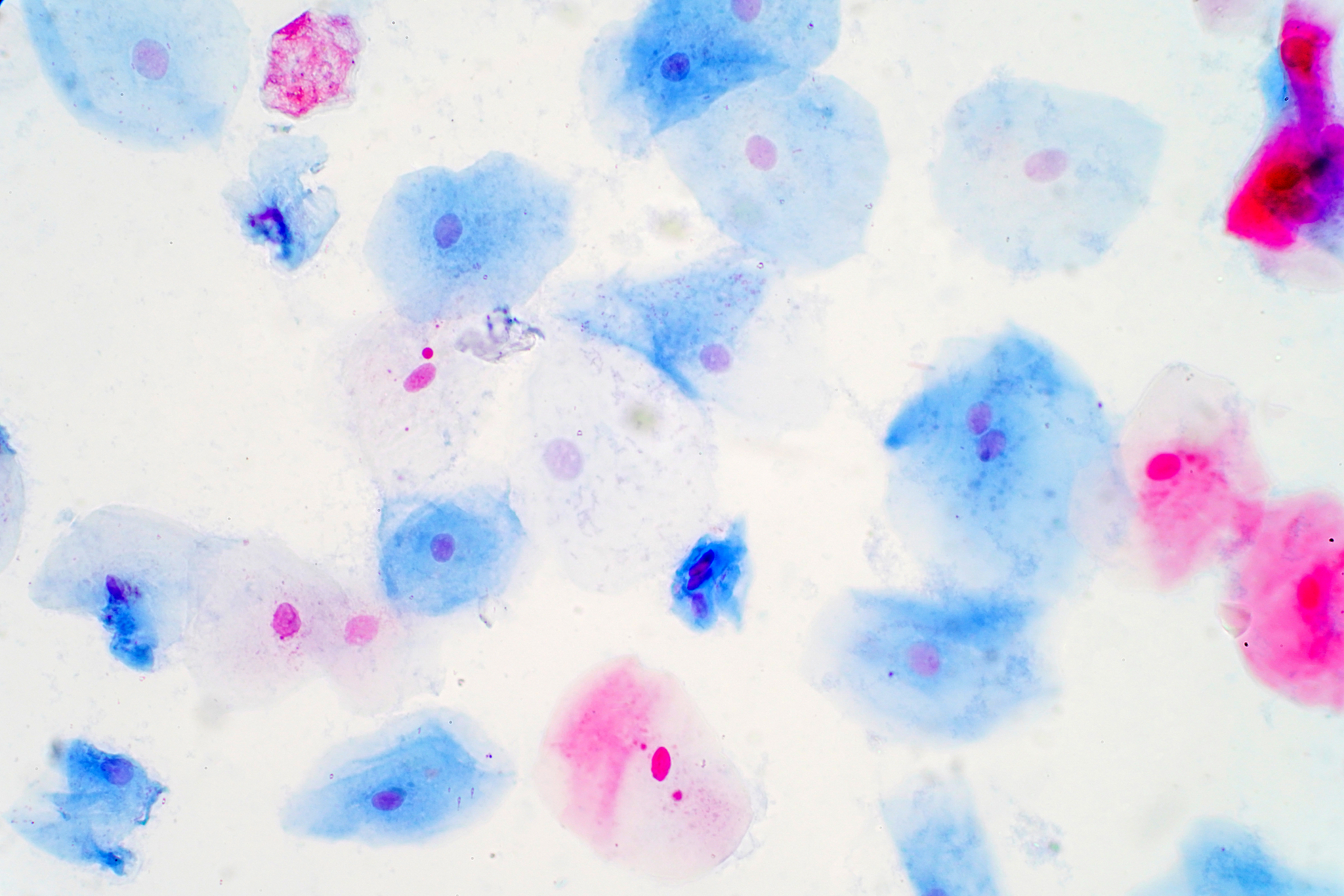 squamous epithelial cells under microscope view for education hi