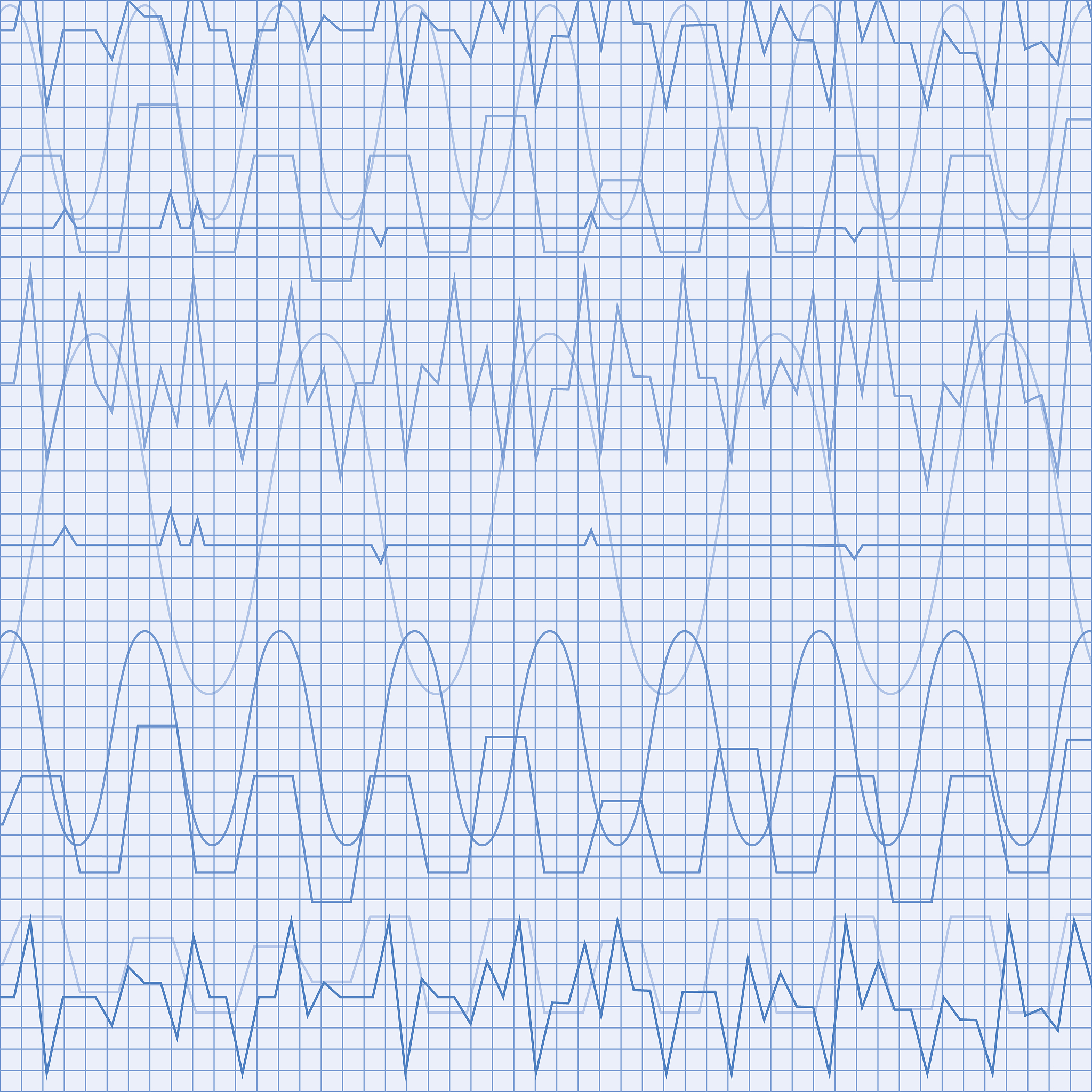 对以下文字进行重写要求知网查重不超过15：小波变换技术在提升 Q 波检测的准确性方面表现出了良好的性能。根据小波变换理论R 波峰与 模最大模数最小值的零点具有稳定的位移关系。 因此使用小波变换来检测 QRS 波是通过定位 R 波的方法的最大值的模数来检测 R 波从 R 峰值位置开始 选择较小的刻度向前和向后搜索 QRS 波开始和结束以避免 QRS 波的宽度失真。对于干扰严重或非典型 R 波的情况需