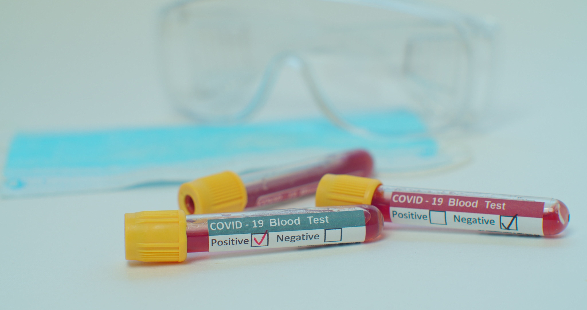 covid-19 test and laboratory sample of blood testing for diagnos