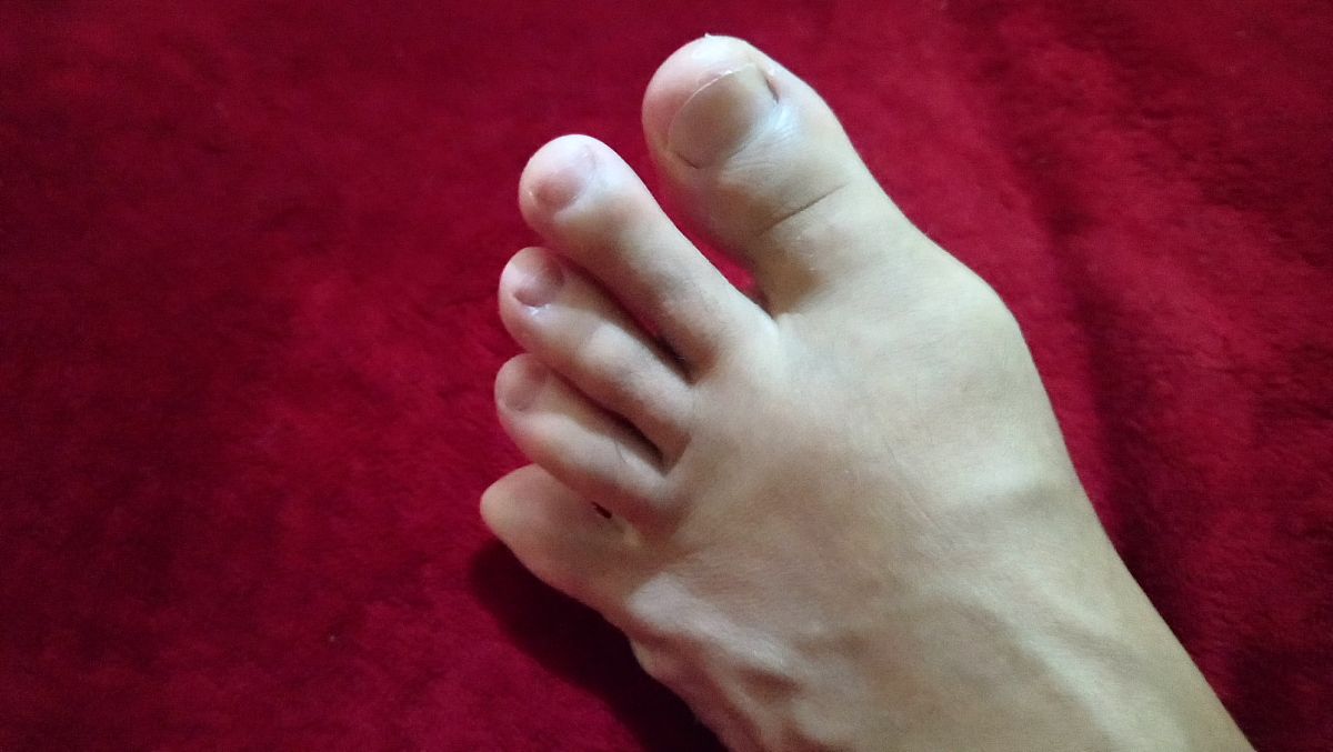 袜子穿了一天脚尖和脚跟黄了