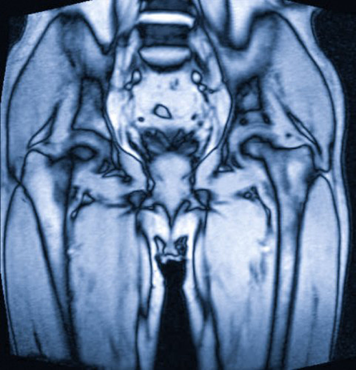 盆骨疼痛的原因：受凉、月经期、过度劳累等，如何缓解？