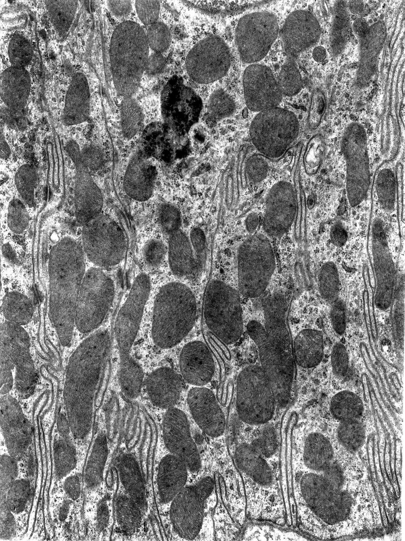 Microstructural Evolution of BCFZY Electrode during Sintering