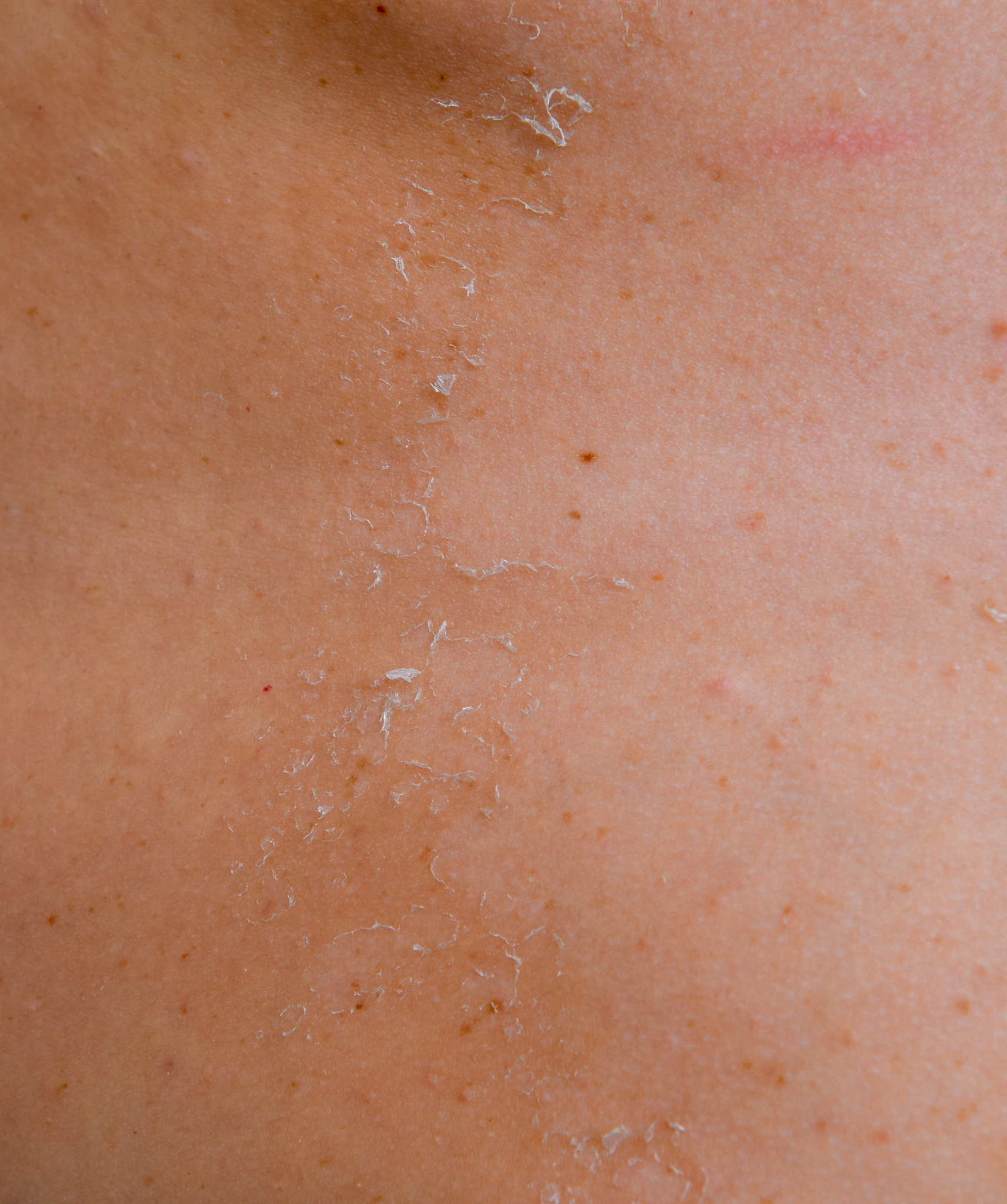 如果一个人长时间用湿泥土覆盖全身他的皮肤会发生什么变化