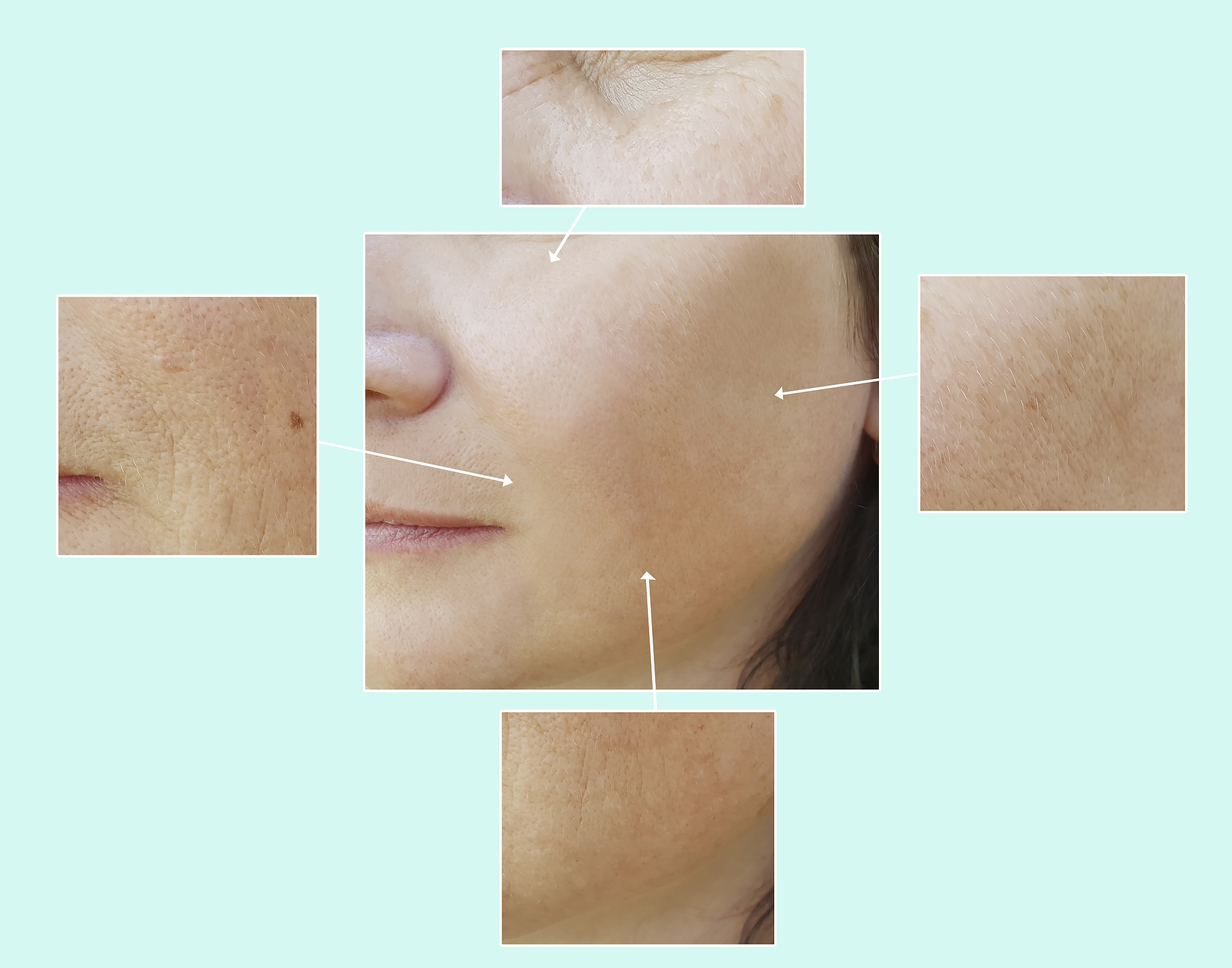 皮肤毛孔会闭合么? 皮肤毛孔会闭合么?