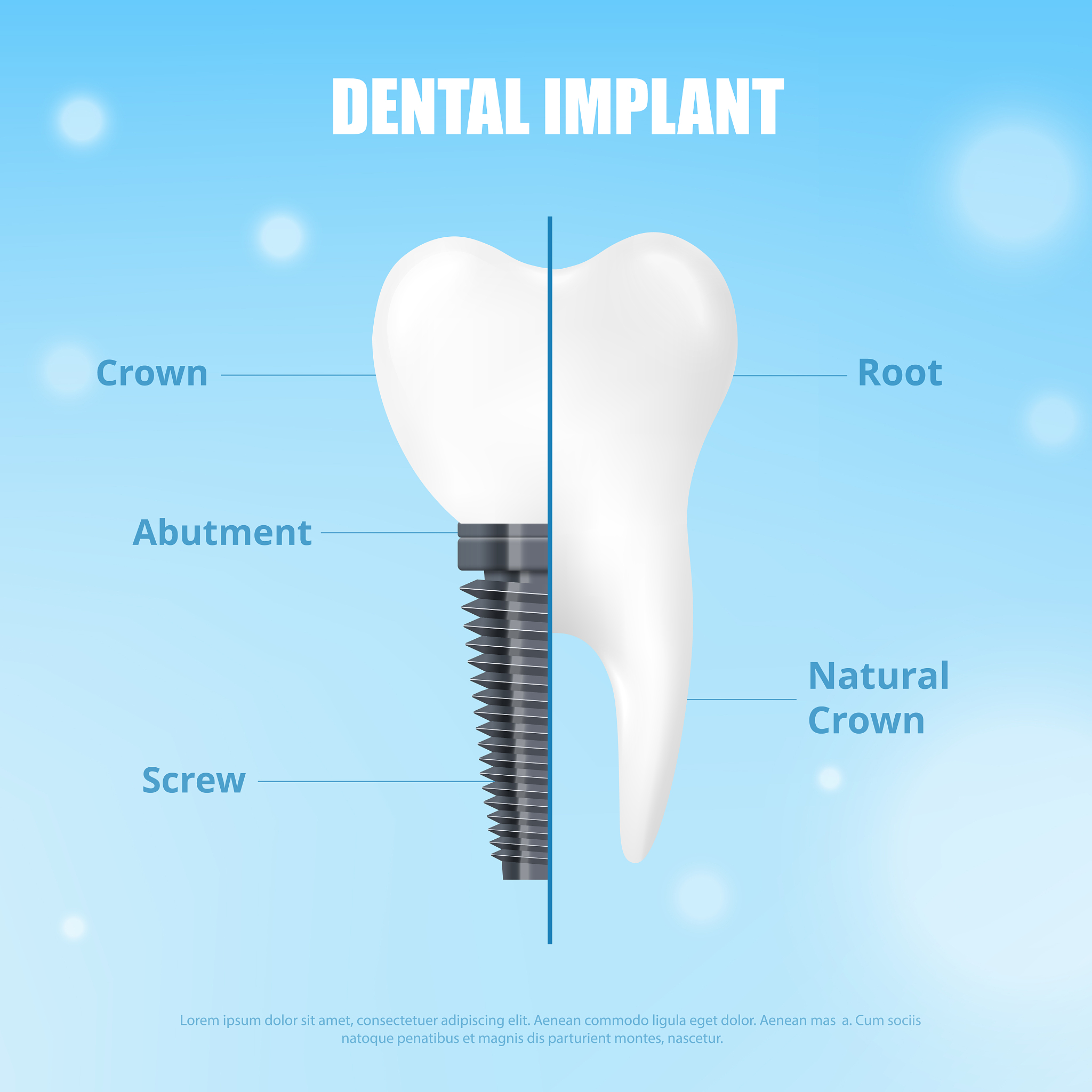 请给《口腔种植学中生物力学方法汇总》这一文章写一个结尾