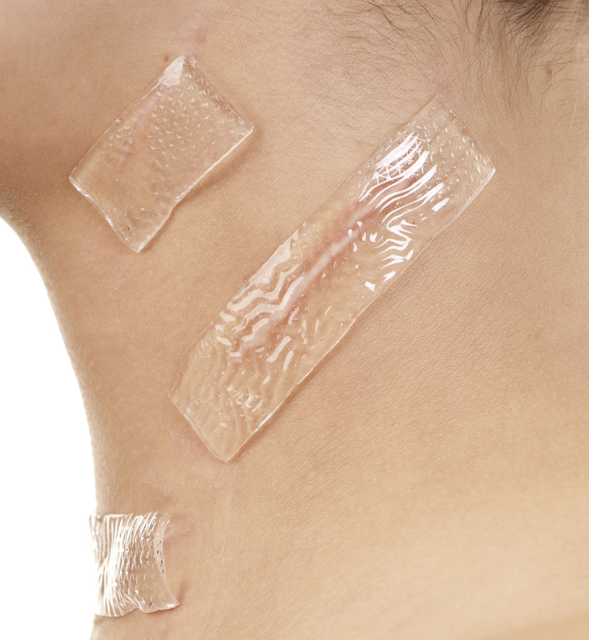 碘含片功效与用途：预防和治疗甲状腺疾病