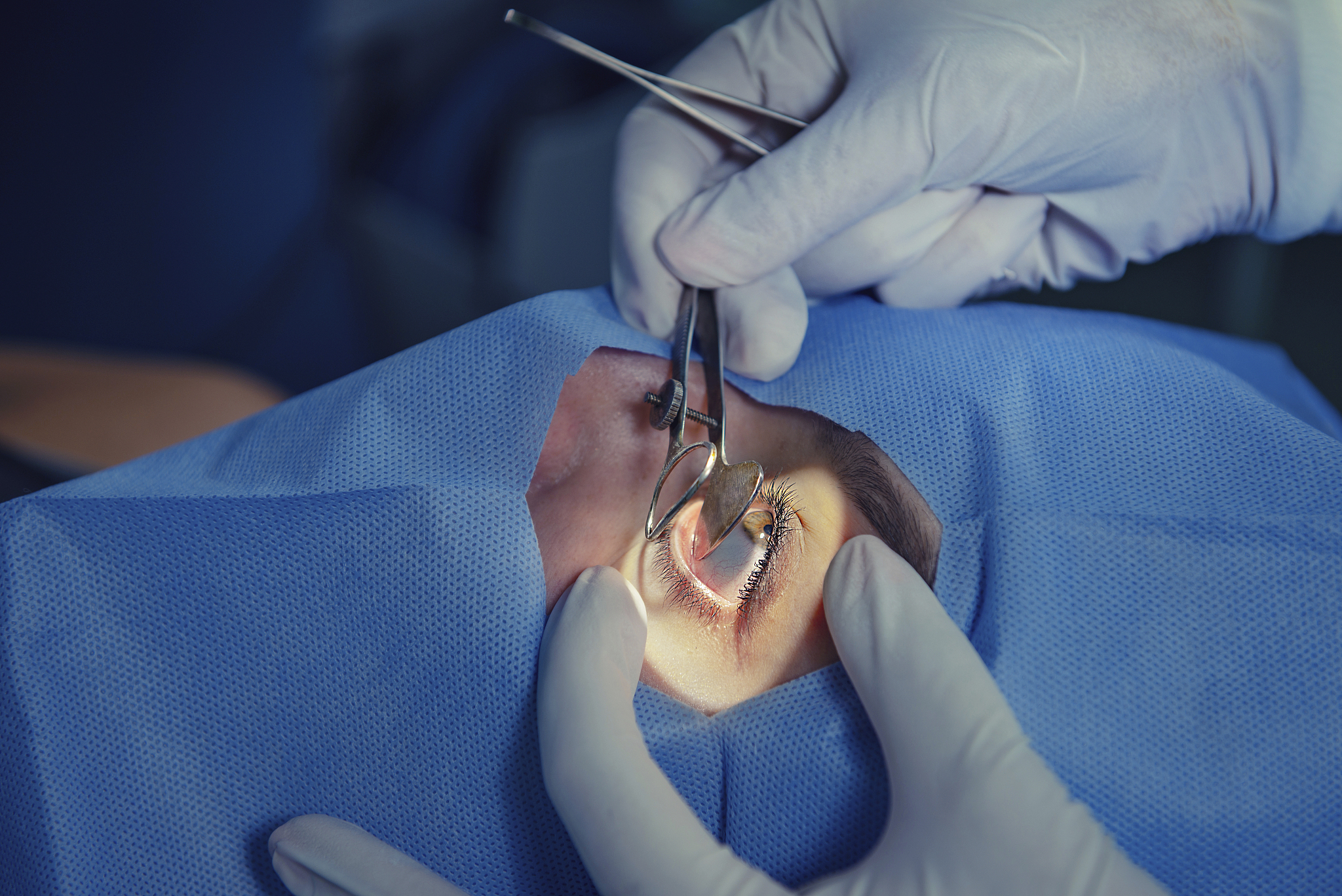 eye surgery