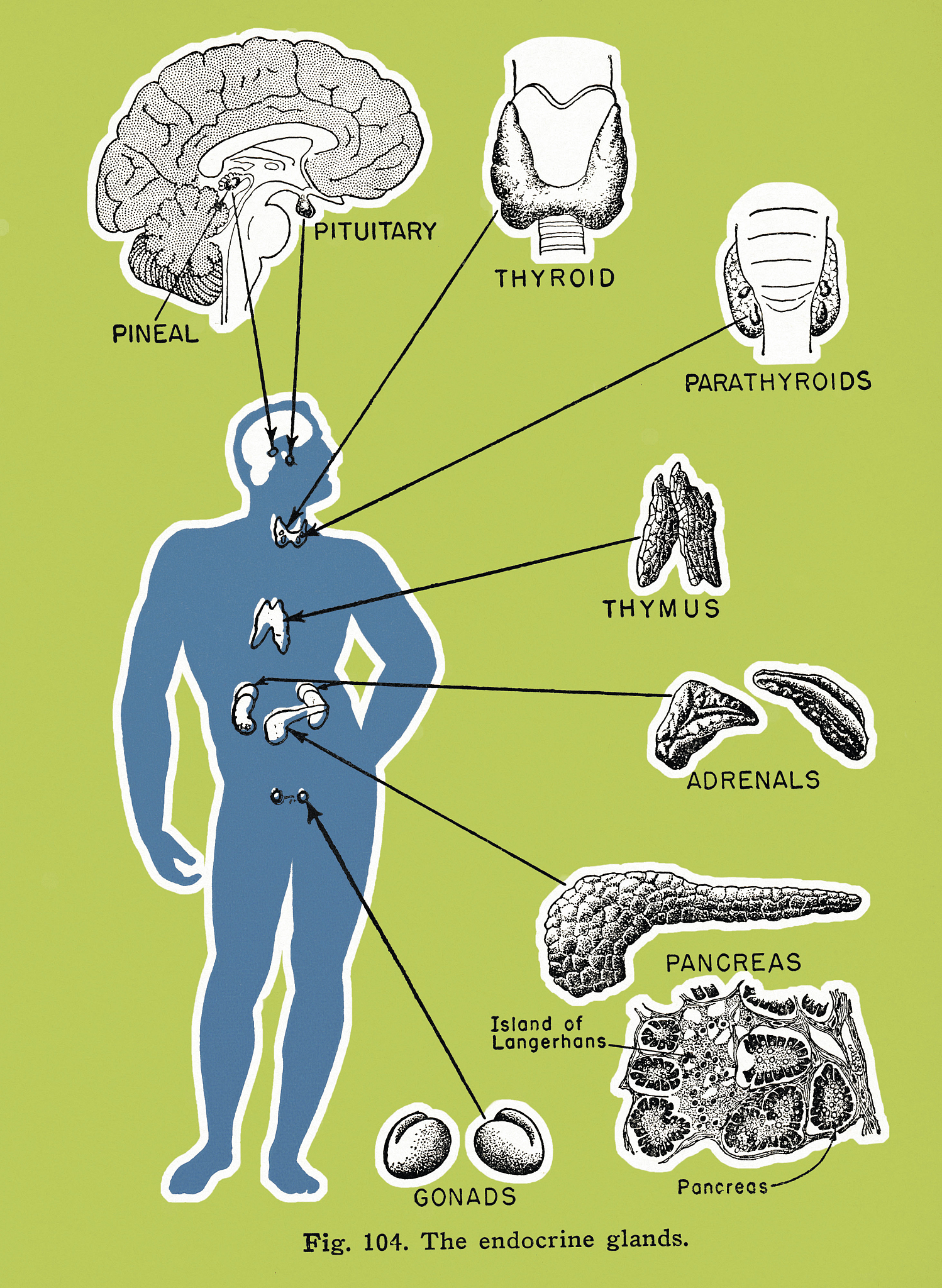 肺炎并发症与癫痫：是什么关系？
