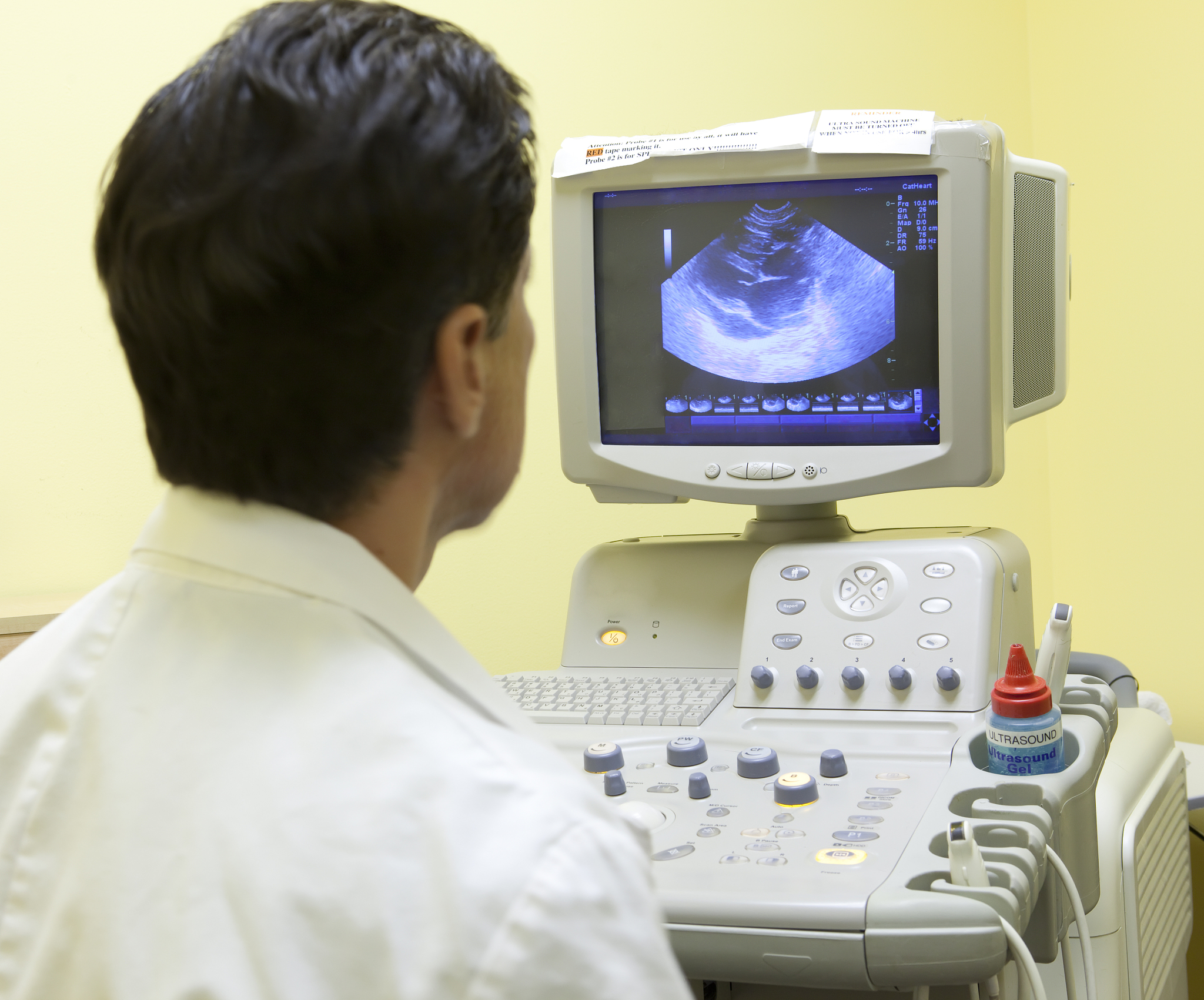 飞利浦和波士顿科学血管内超声诊断导管接头长度 - 10cm