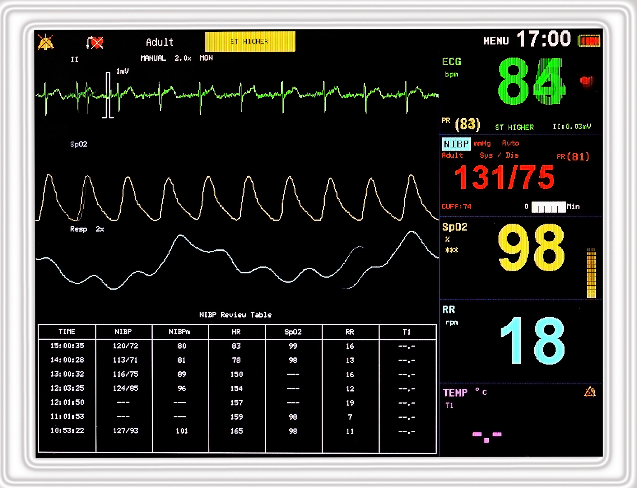 心脏瓣膜病手术：术前麻醉护理全解析