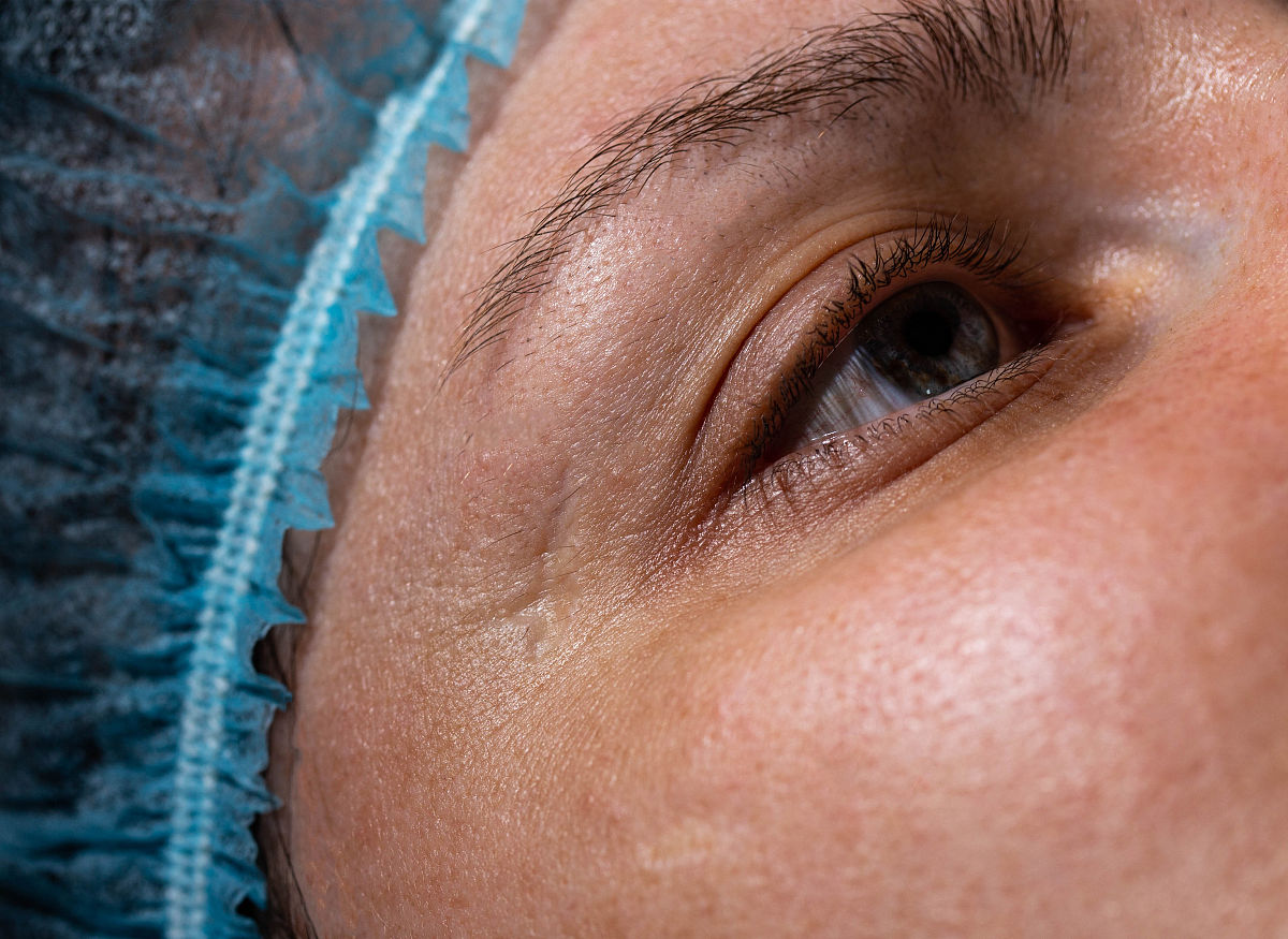 怎么对付揭人伤疤的人