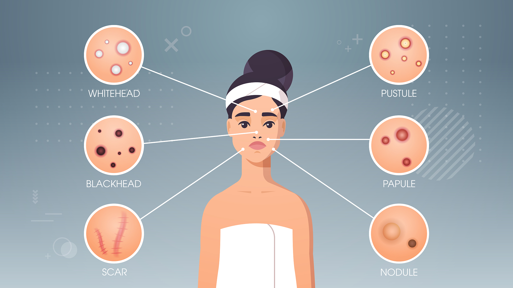 长痘痘痘印影响了我的心情