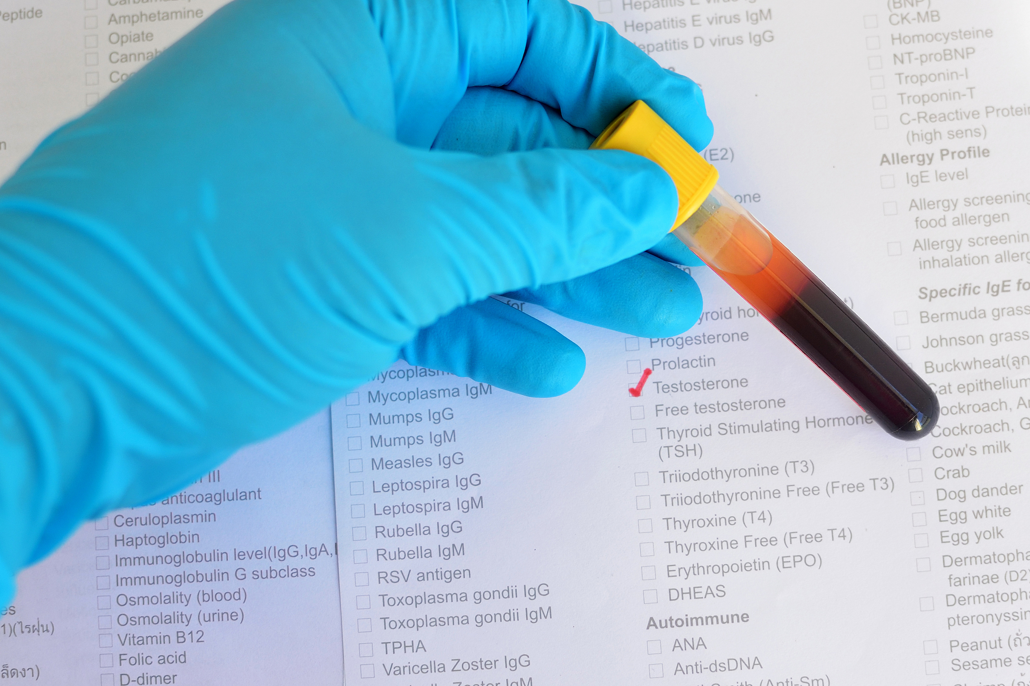 有人就一个睾丸