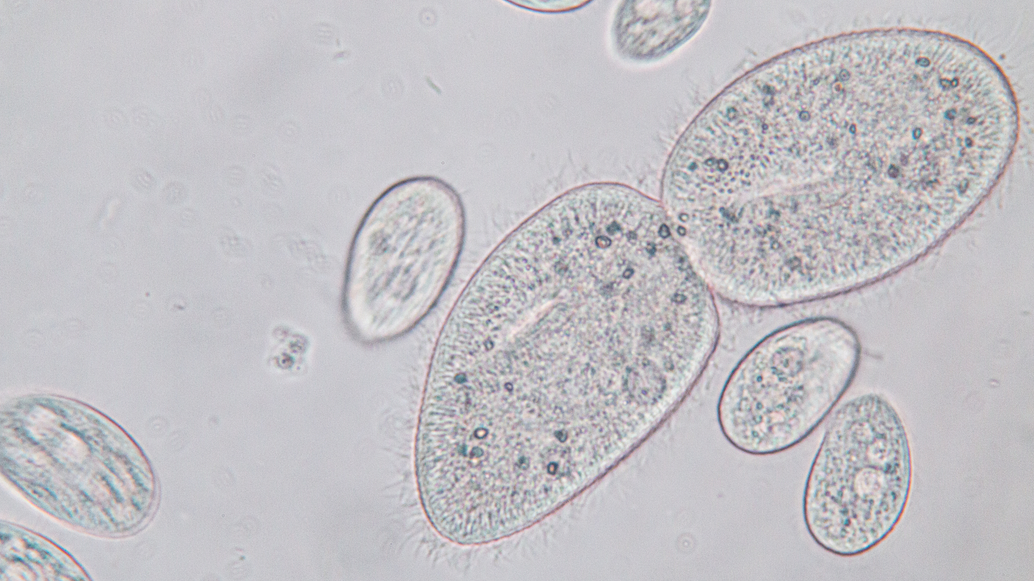 细菌学概述：分类、结构、生理、繁殖、感染与防治