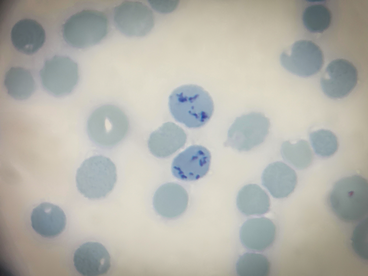 字数不超过200字宣传he染色的优势