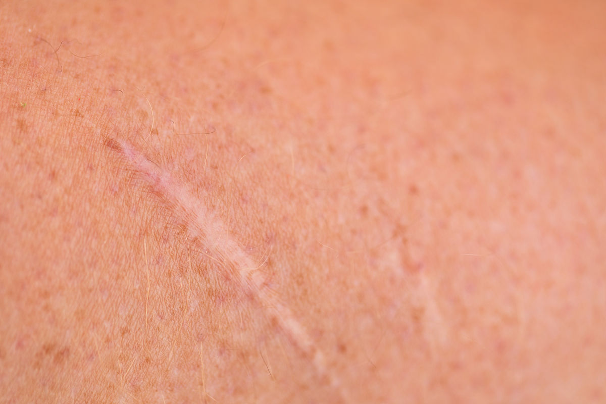 皮肤为什么变硬