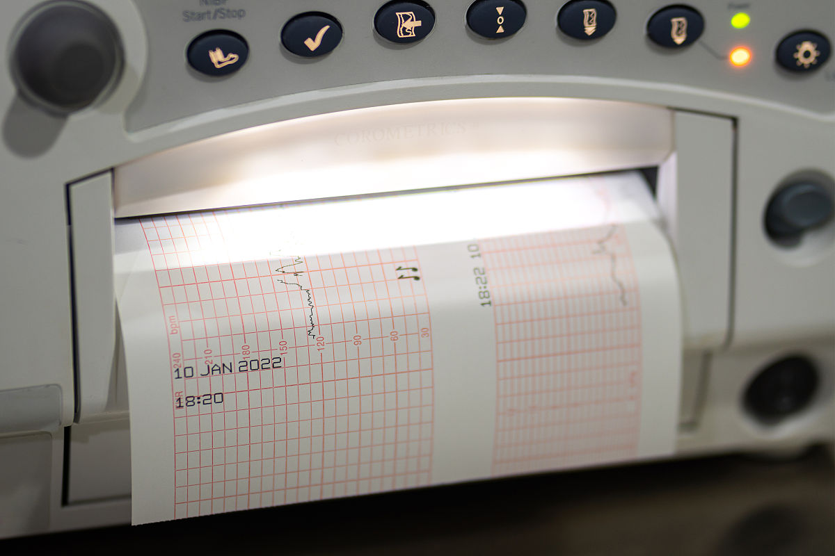 3岁以下宝宝正常心率范围是多少？