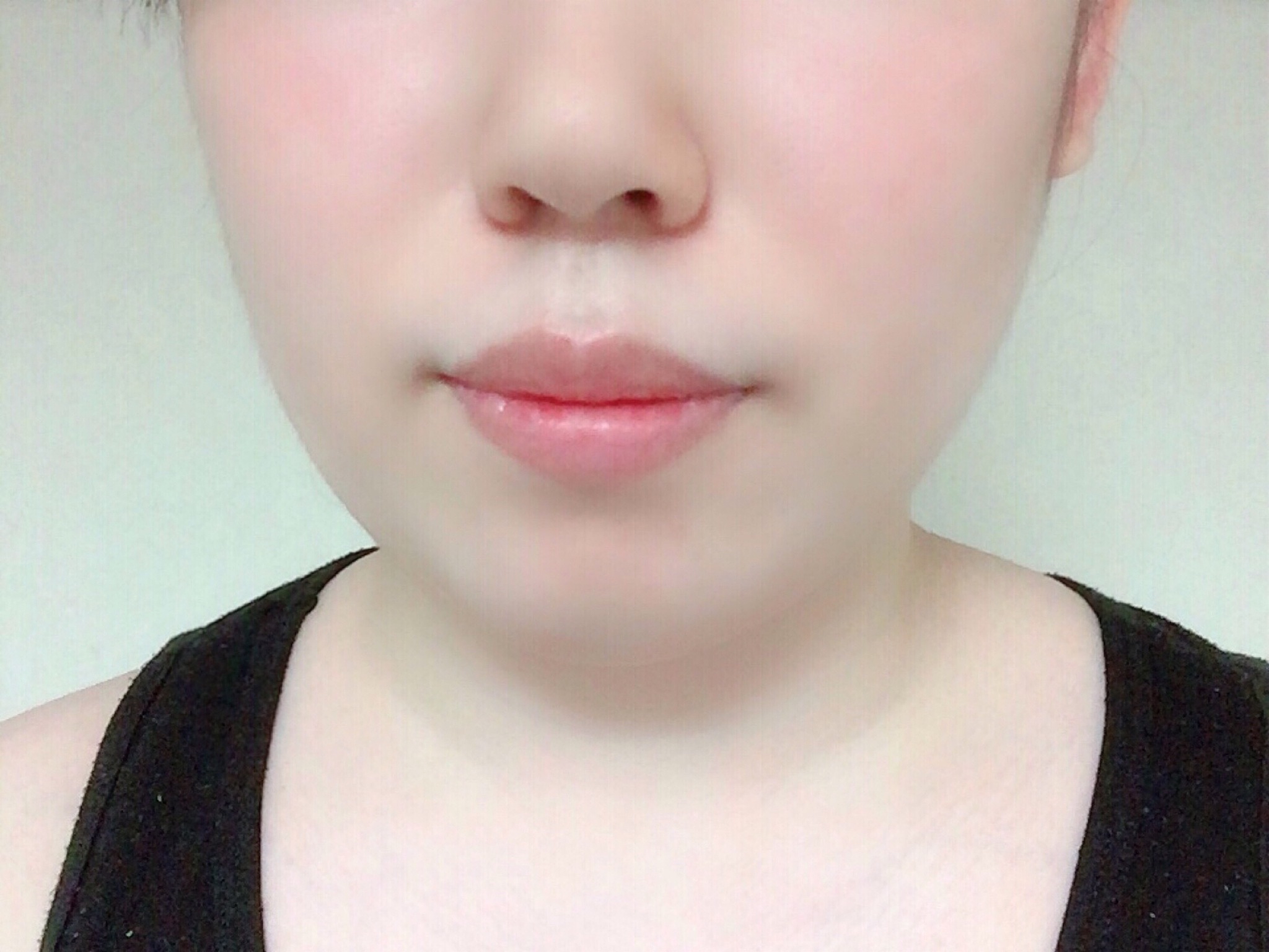 嘴凸原因及解决方法 - 专家建议