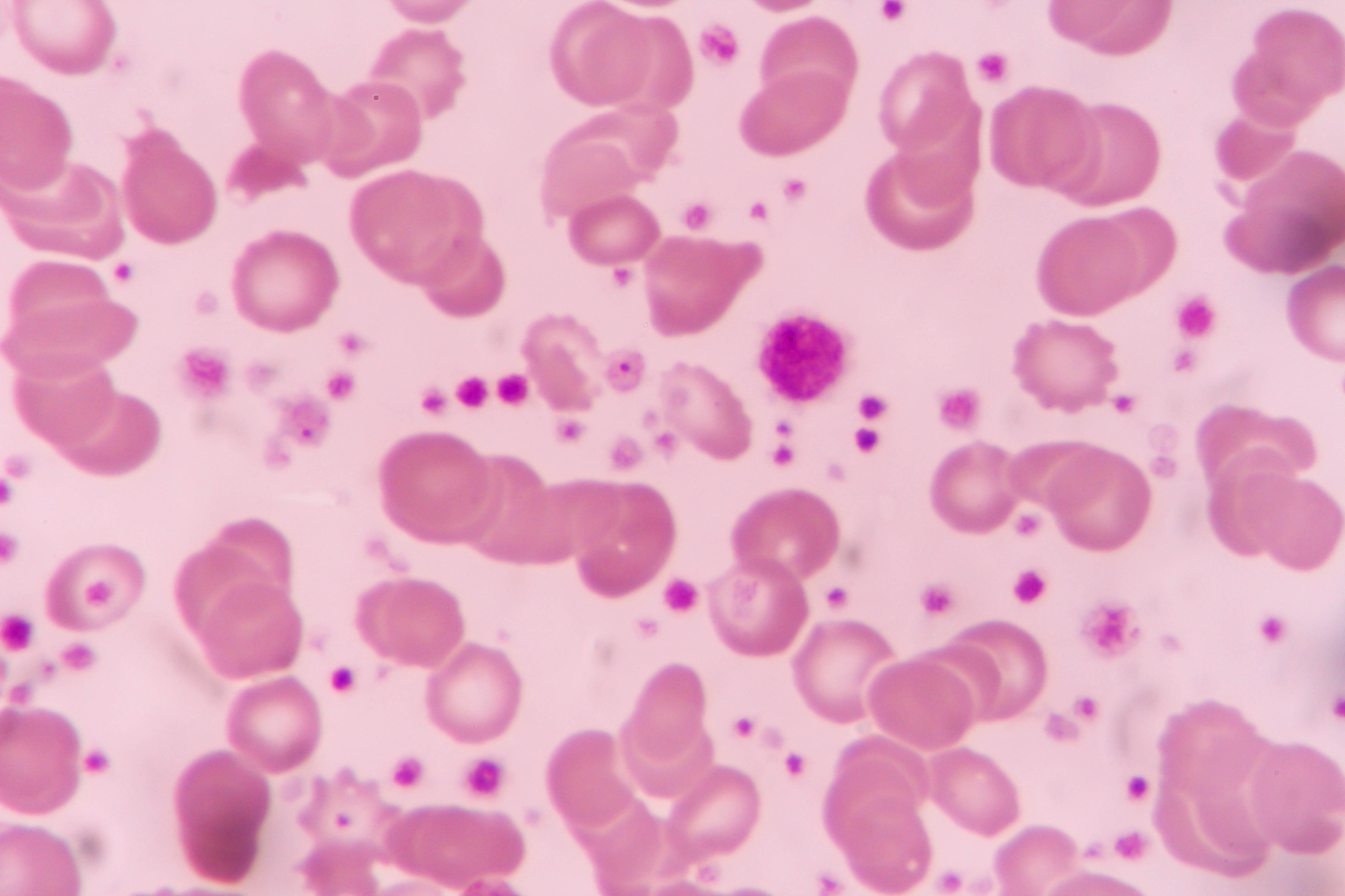 血凝反应(Hemagglutination)是什么？