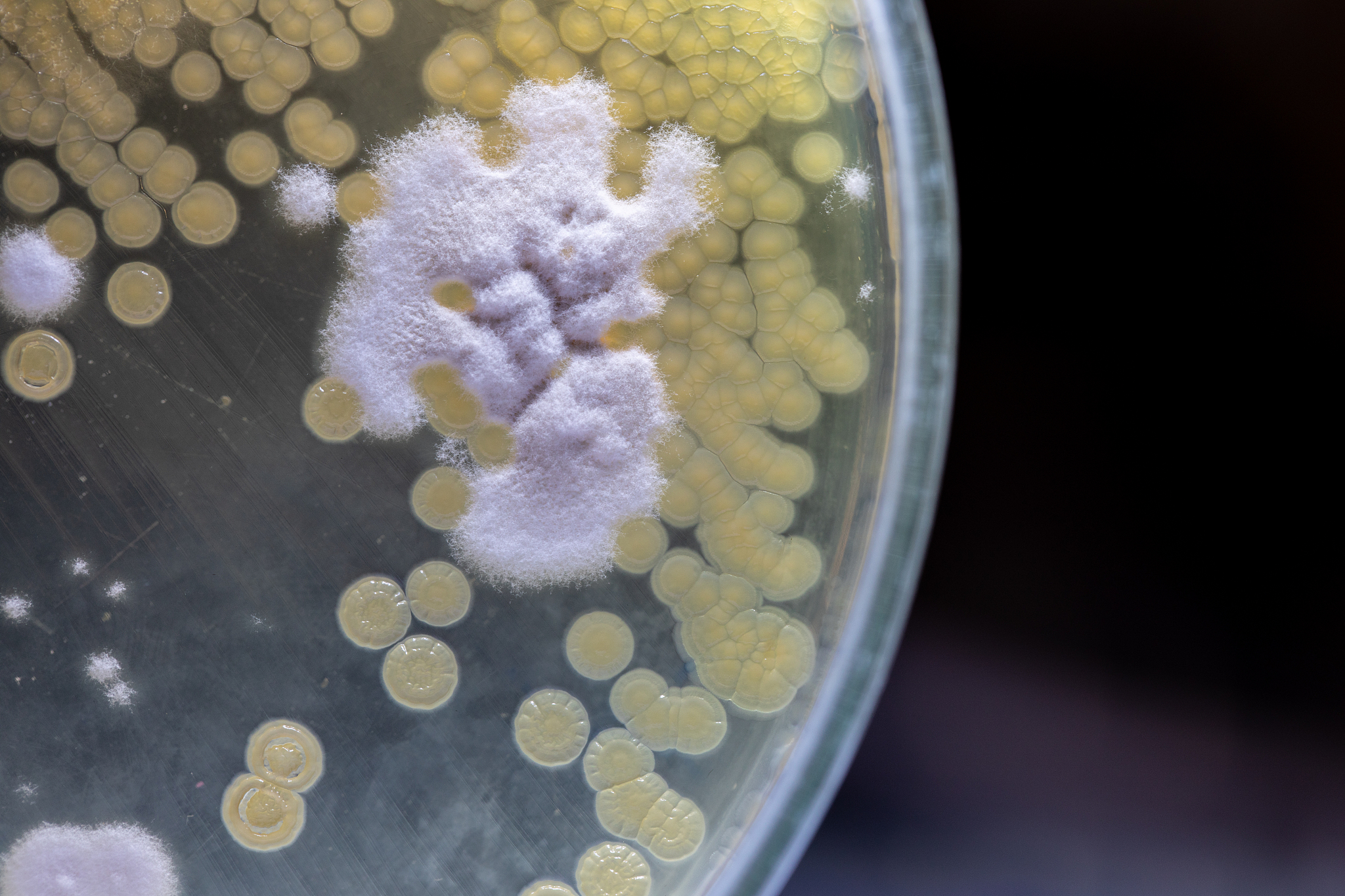 Chaetomium 真菌：室内外常见真菌属