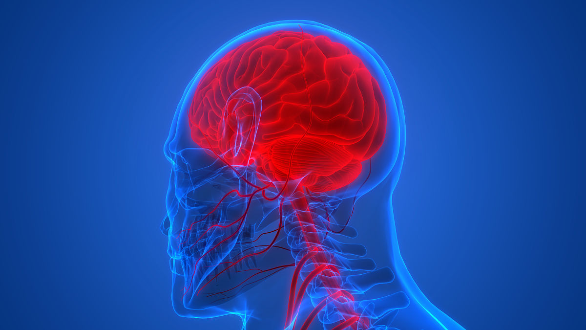 脑出血后神志不清楚该怎么康复脑出血后神志不清楚可能是因为脑部受损导致神经系统功能受损。康复的关键是要进行系统的康复治疗包括药物治疗、物理治疗、语言治疗和心理治疗等。以下是一些康复建议：1 药物治疗：根据患者的病情和症状医生可能会开出一些药物如抗凝血药、保护神经细胞药等以促进康复。2 物理治疗：物理治疗包括运动训练、按摩、理疗等旨在恢复肌肉和神经系统的功能。3 语言治疗：对于患有失语症的患者语言治疗